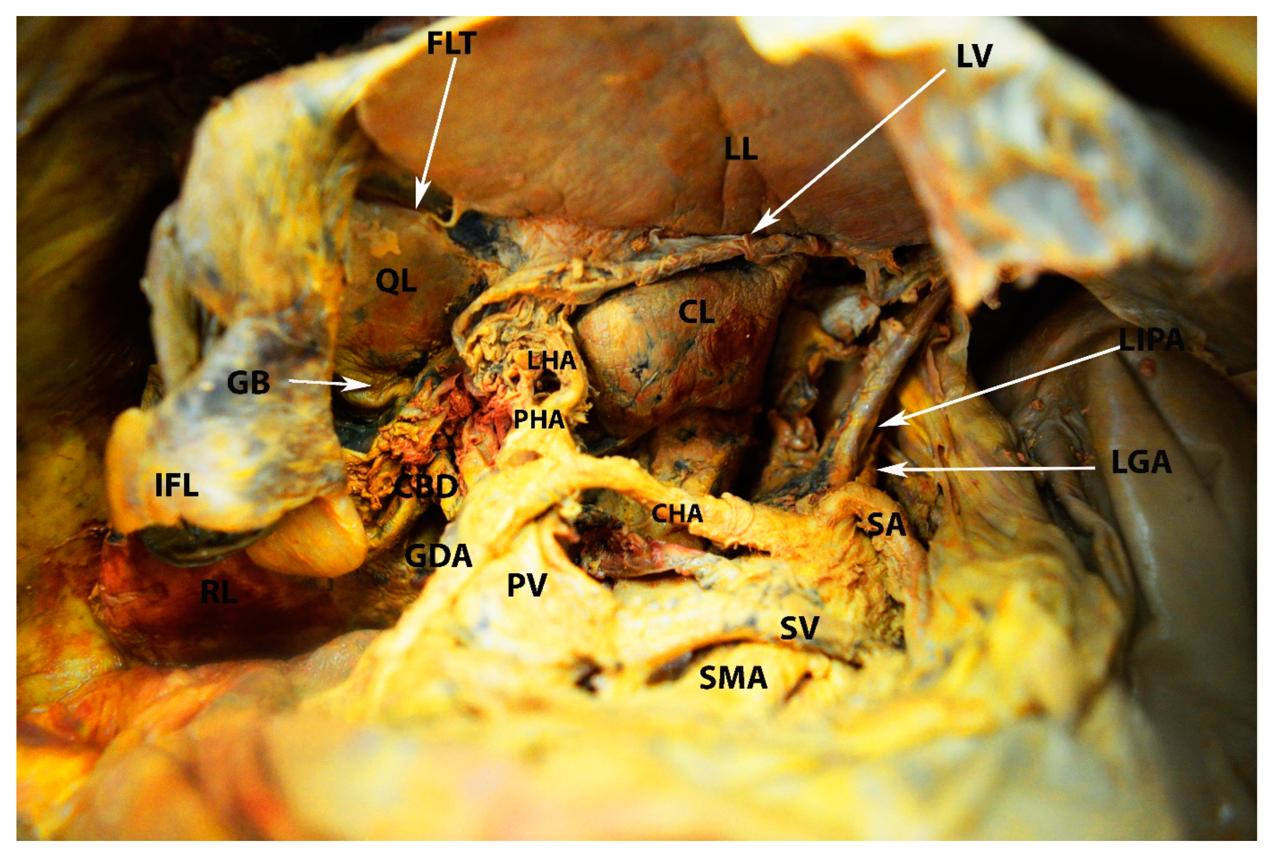 Diagnostics 13 02371 g012 Diagnostics 13 02371 g012
