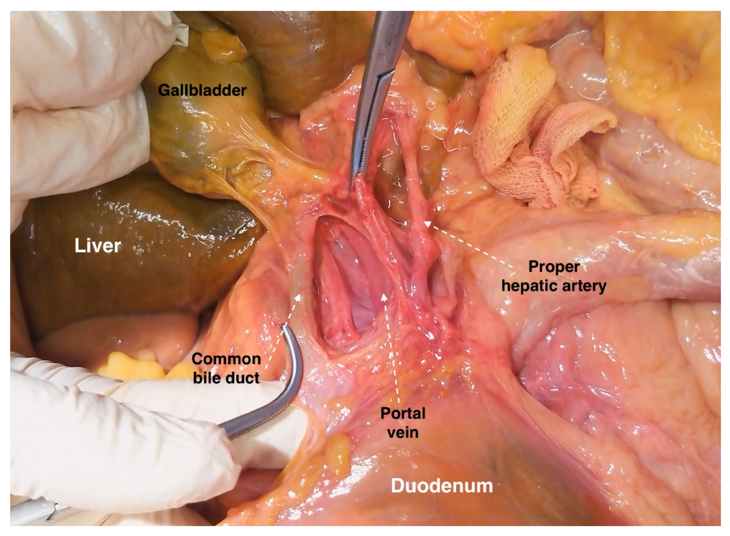 Diagnostics 13 02371 g014 Diagnostics 13 02371 g014