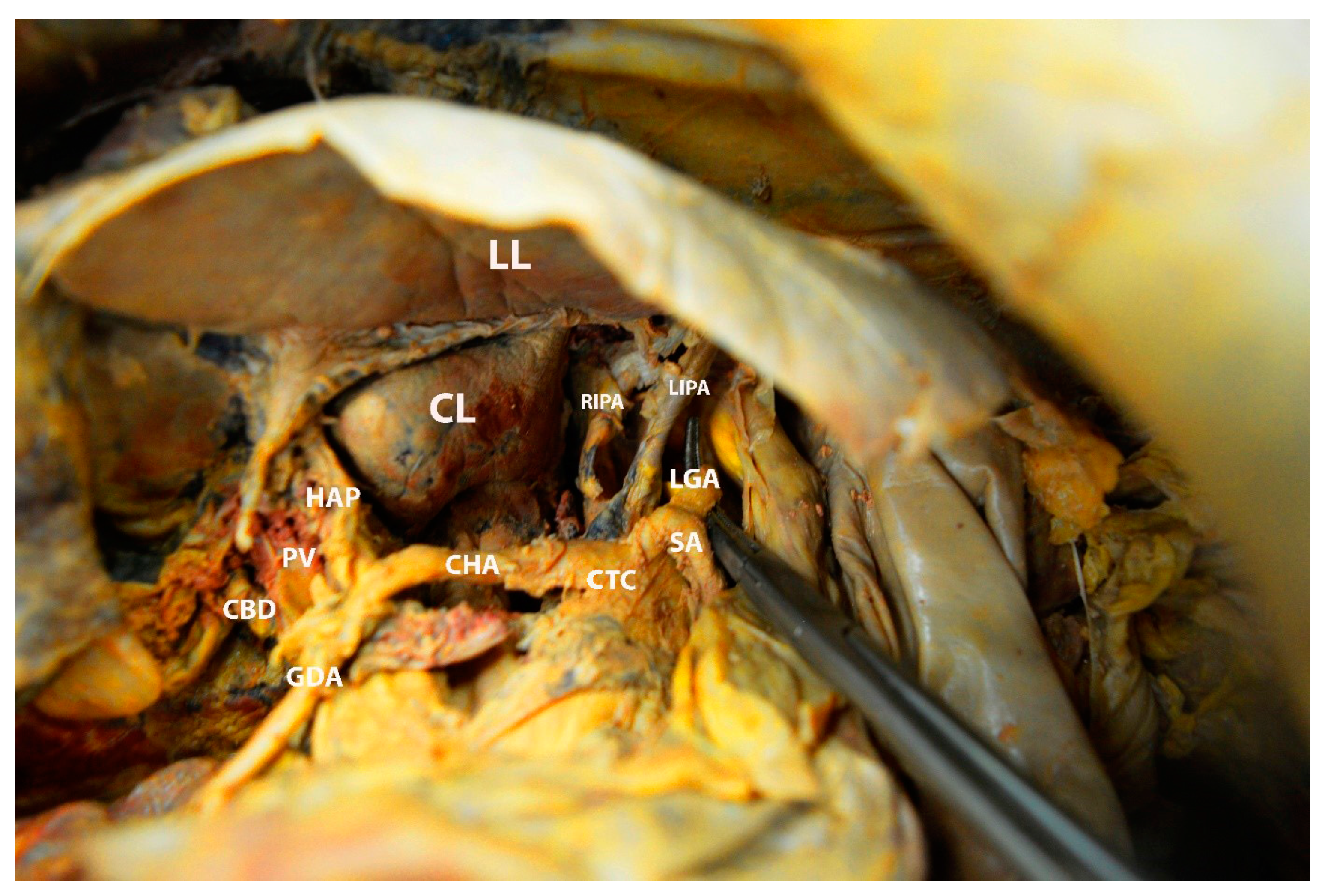 Diagnostics 13 02371 g016 Diagnostics 13 02371 g016
