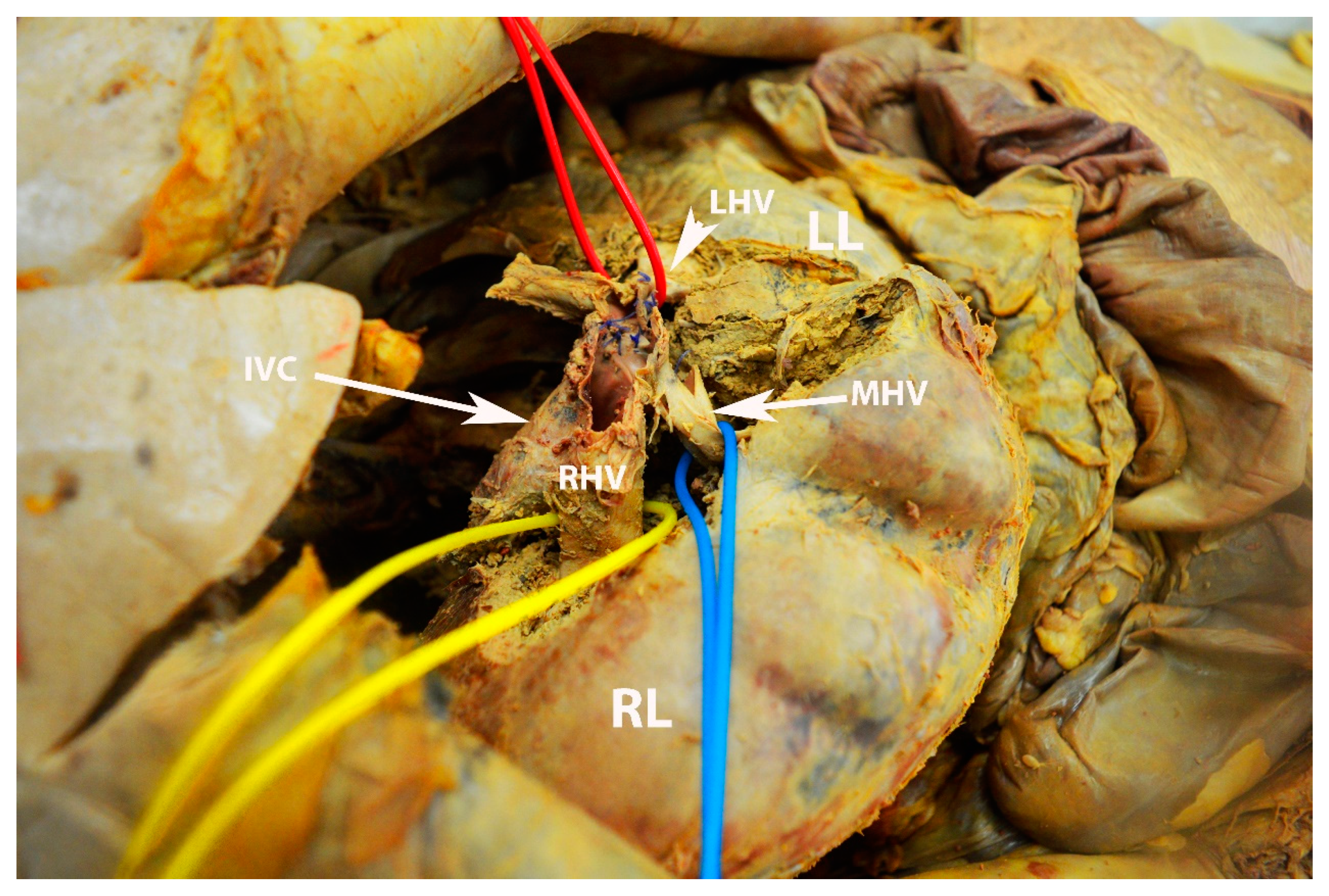 Diagnostics 13 02371 g018 Diagnostics 13 02371 g018