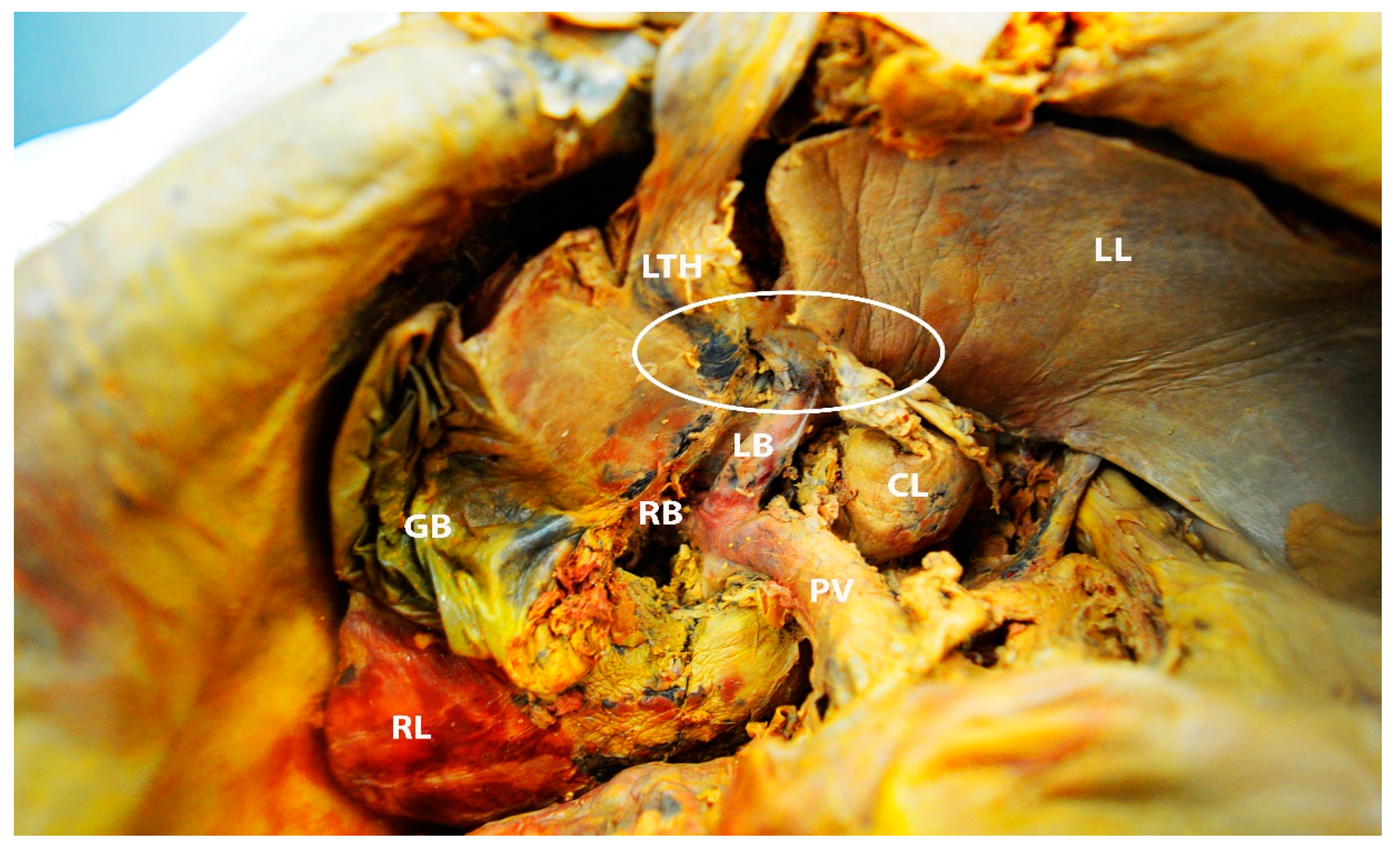 Diagnostics 13 02371 g022 Diagnostics 13 02371 g022