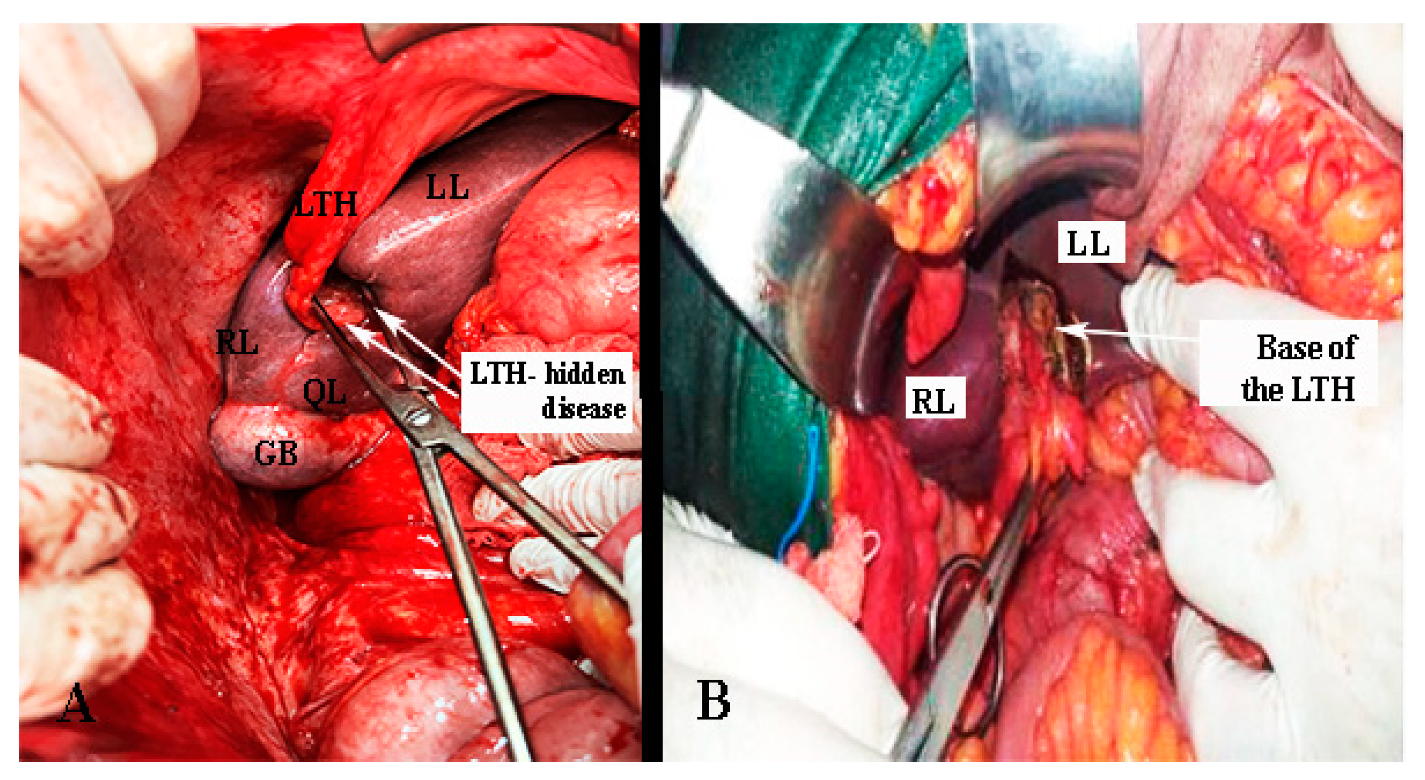 Diagnostics 13 02371 g023 Diagnostics 13 02371 g023