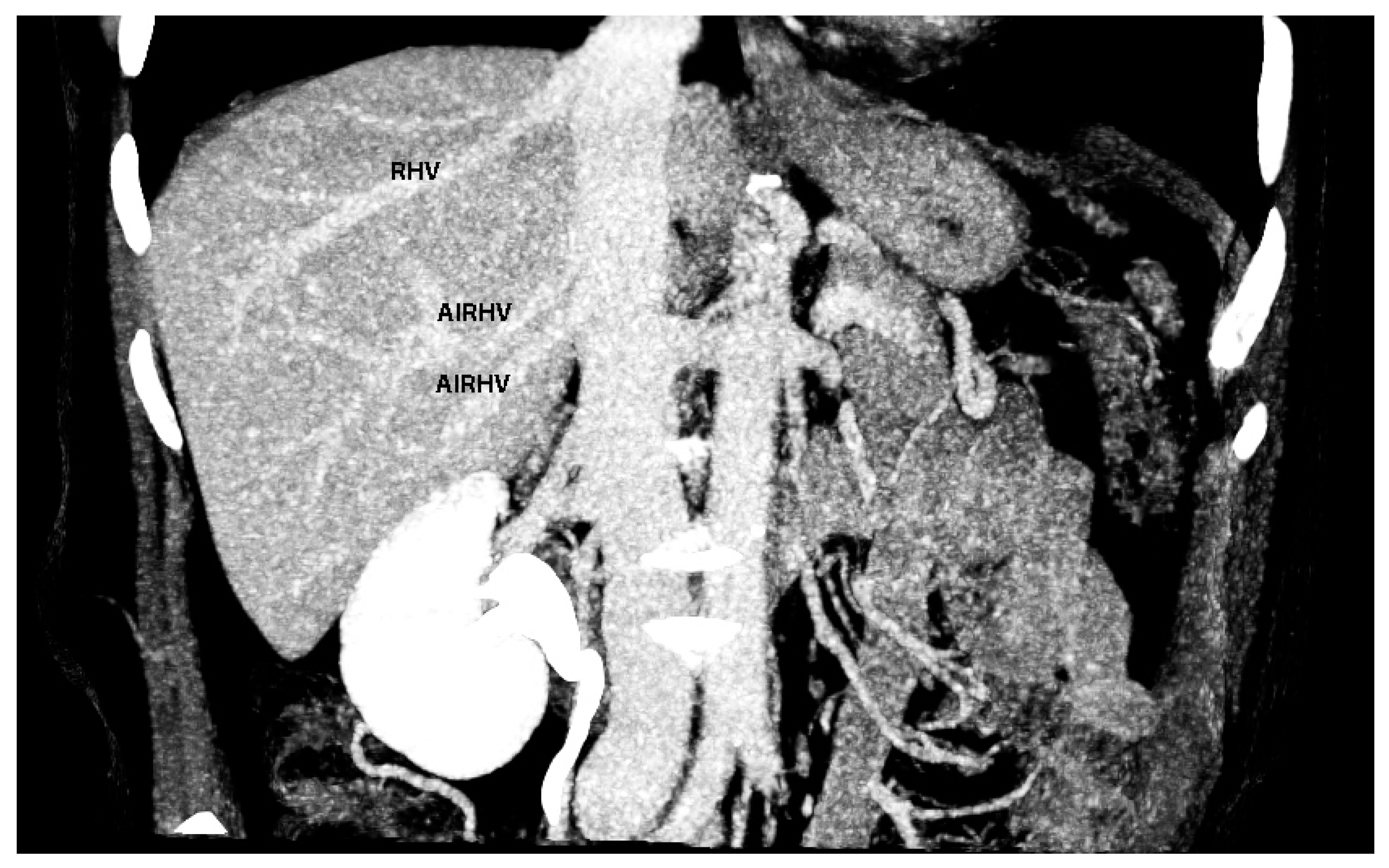 Diagnostics 13 02371 g024 Diagnostics 13 02371 g024