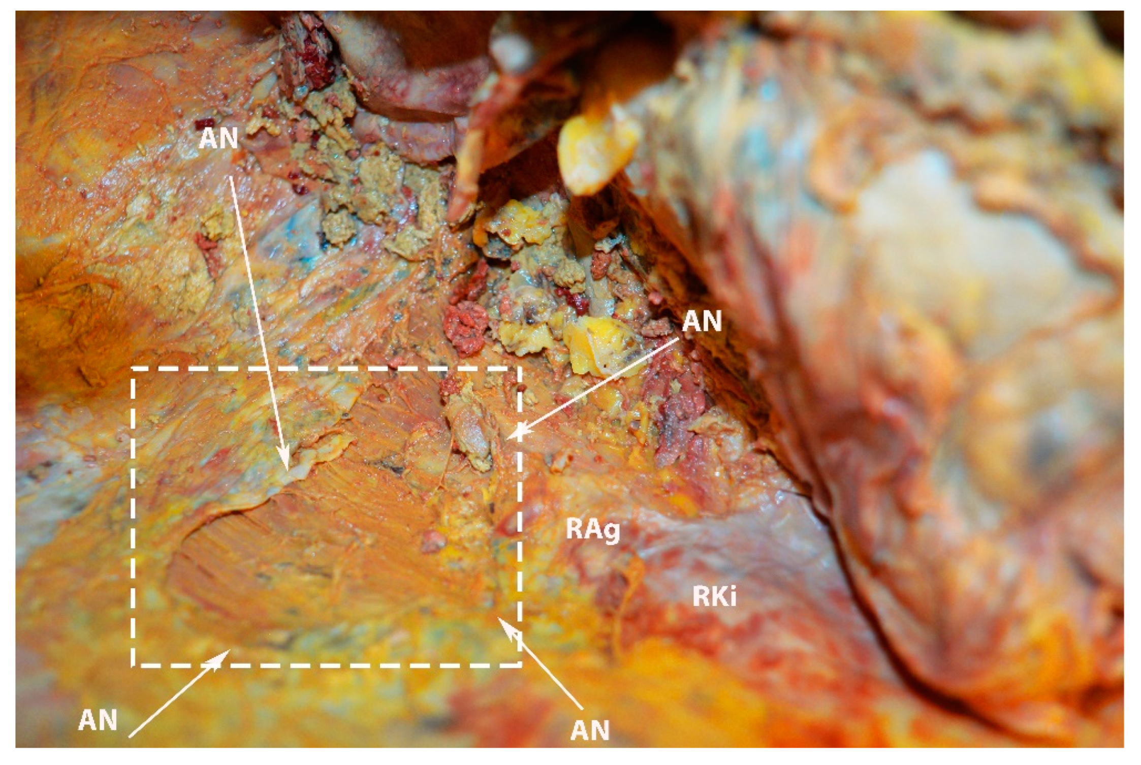 Diagnostics 13 02371 g025 Diagnostics 13 02371 g025