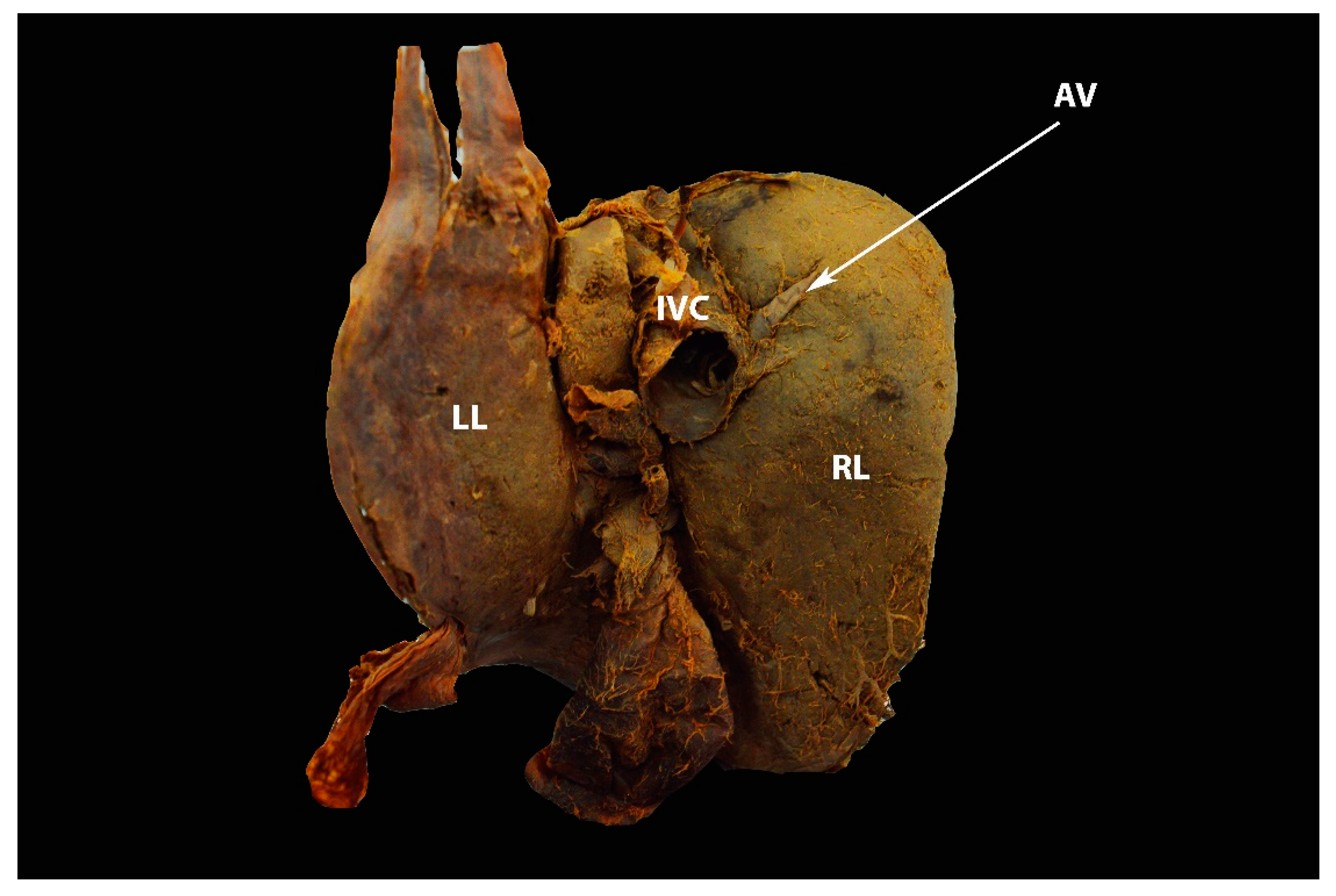 Diagnostics 13 02371 g026 Diagnostics 13 02371 g026