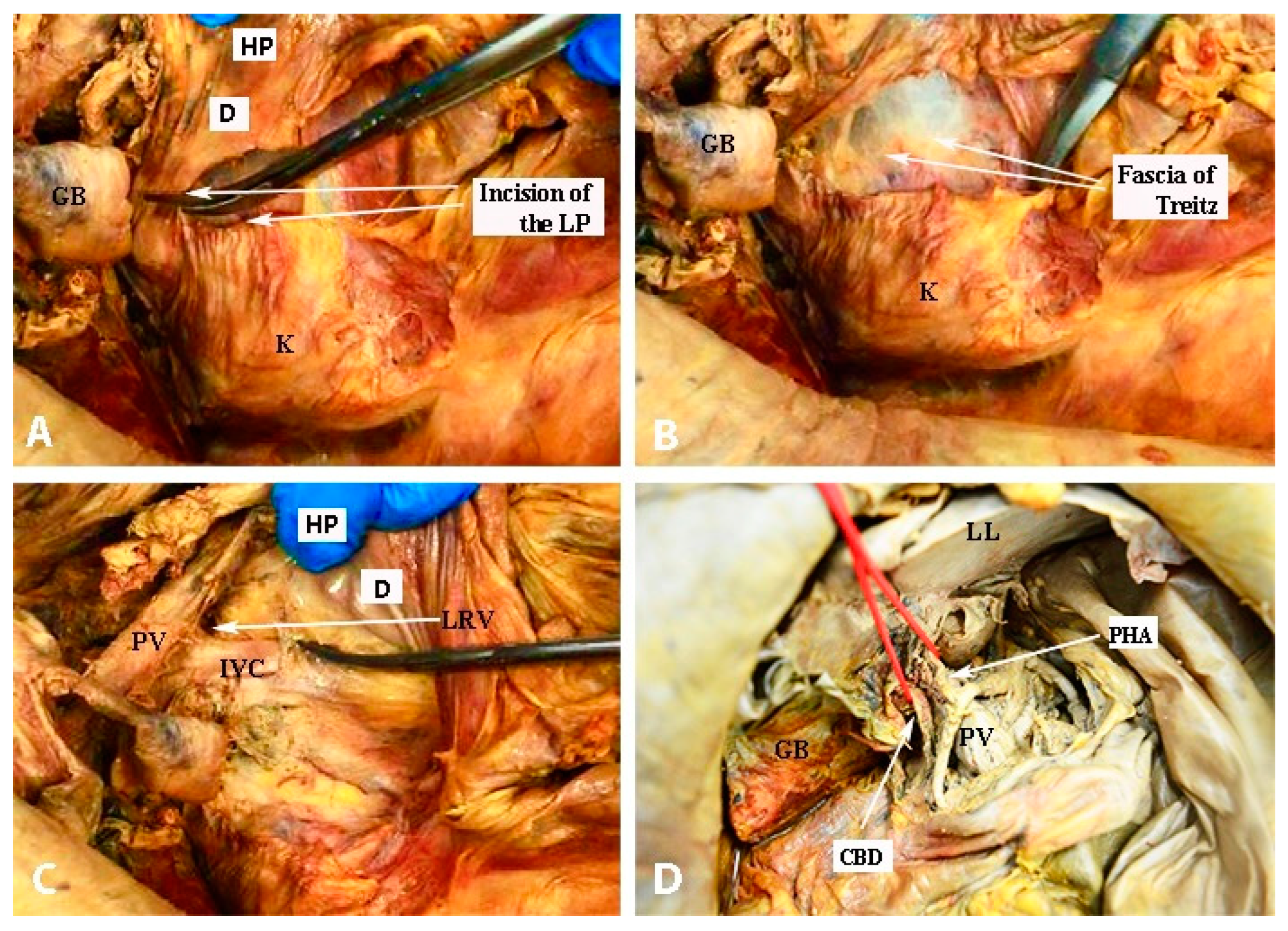 Diagnostics 13 02371 g028 Diagnostics 13 02371 g028