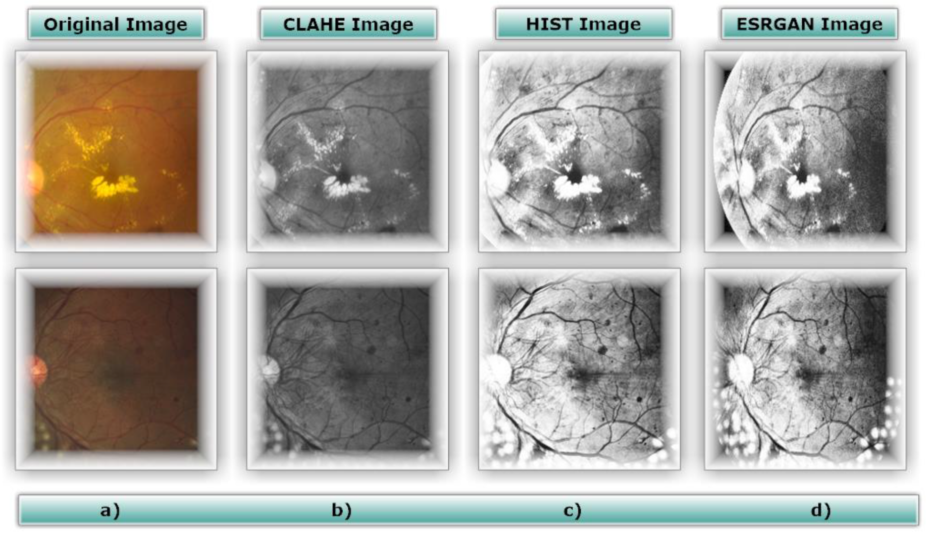 Diagnostics 13 02375 g005