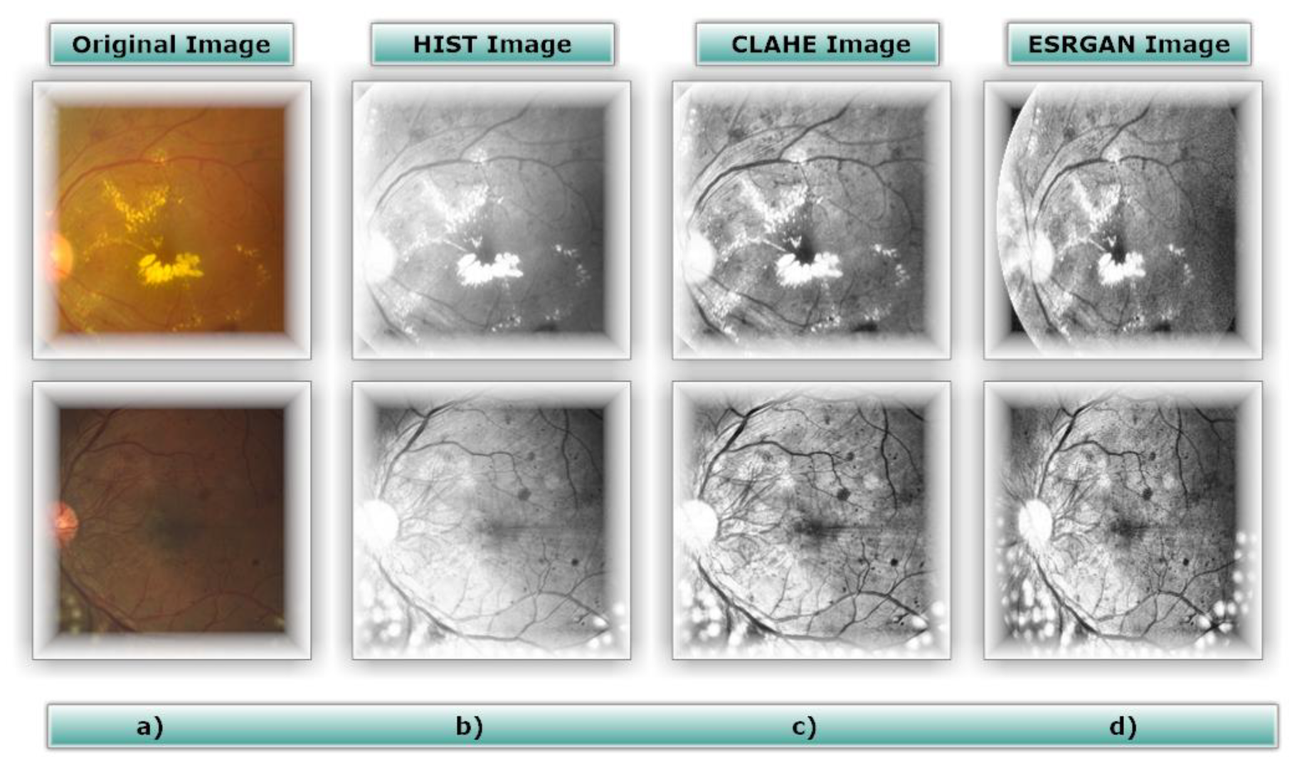 Diagnostics 13 02375 g006