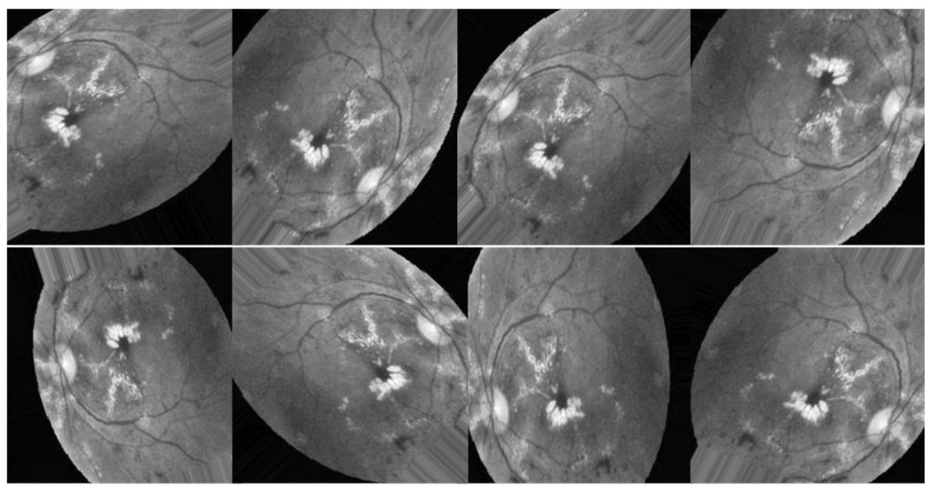 Diagnostics 13 02375 g008