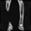 Diagnostics 13 02377 i001