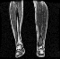 Diagnostics 13 02377 i026