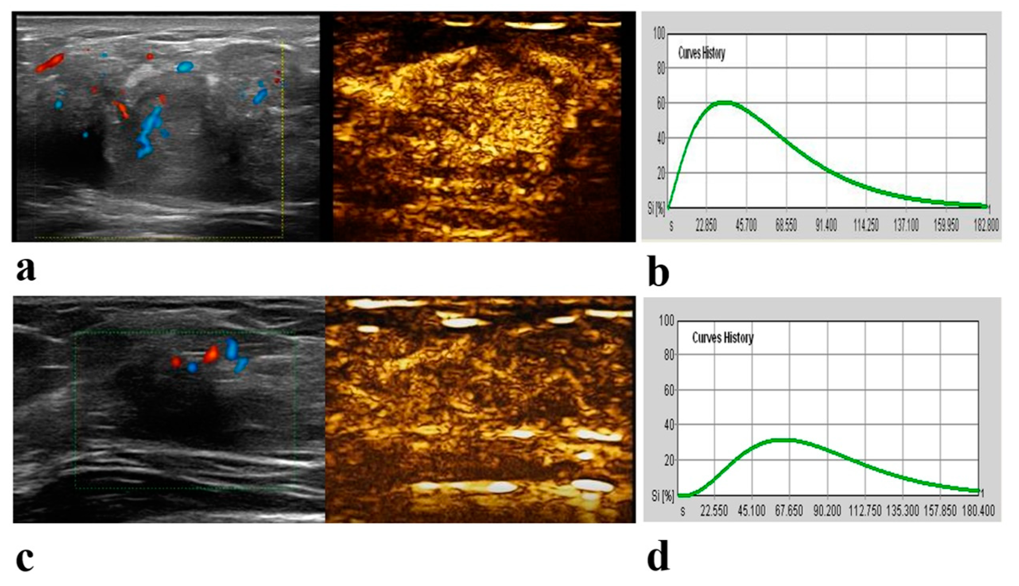 Multiparametric Contrast-Enhanced Ultrasound in Early