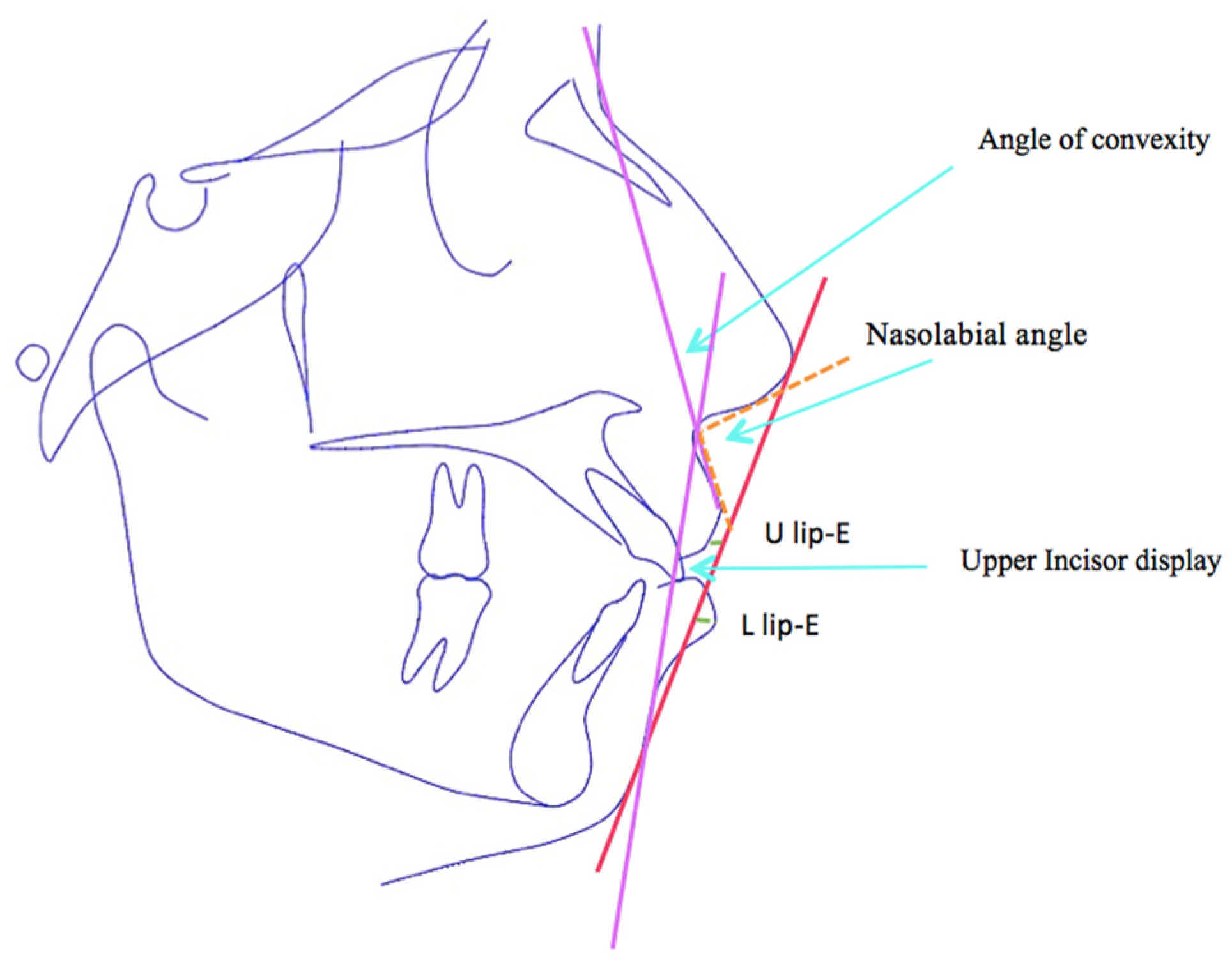Diagnostics 13 02395 g004