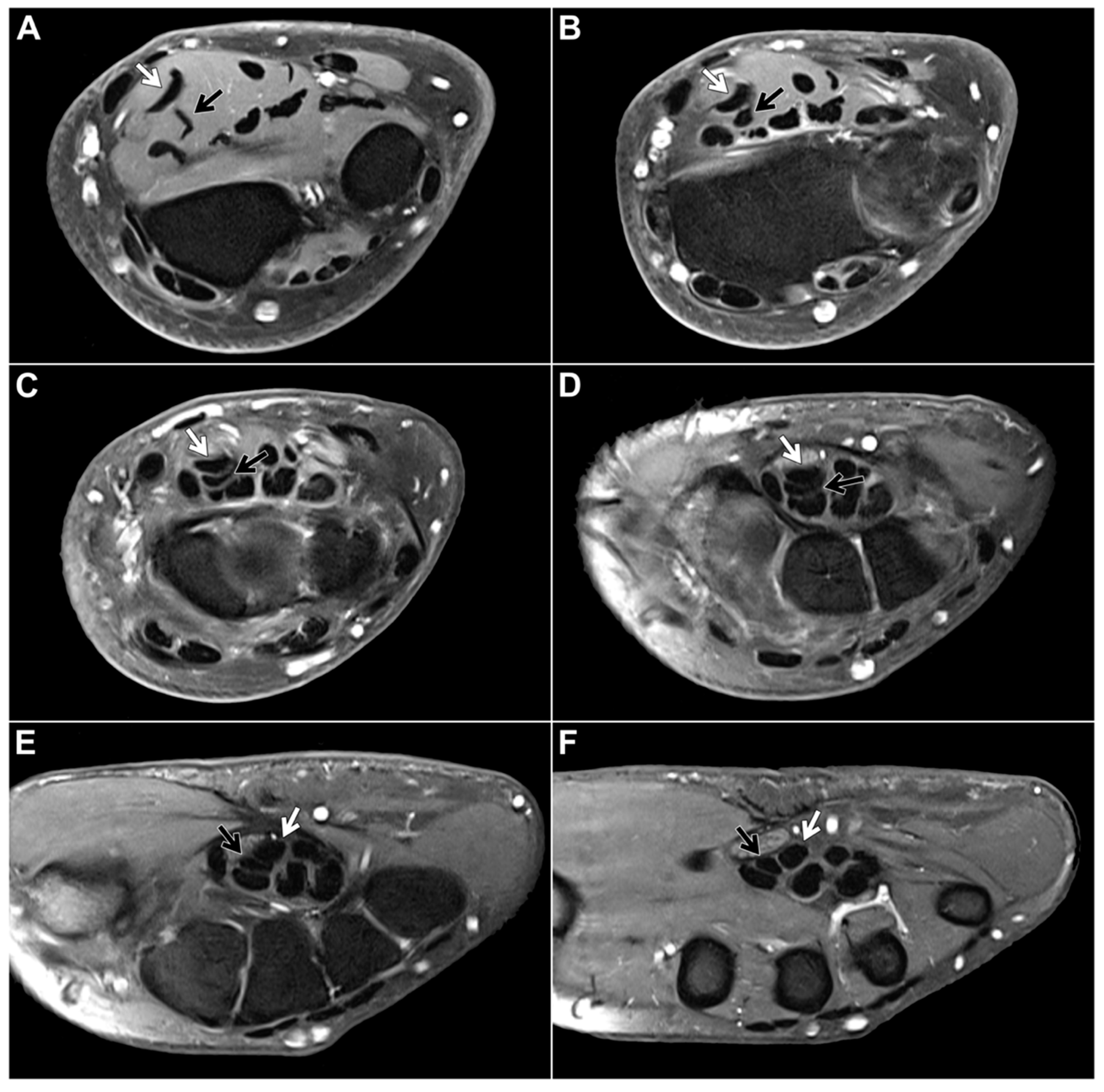 Diagnostics 13 02406 g002