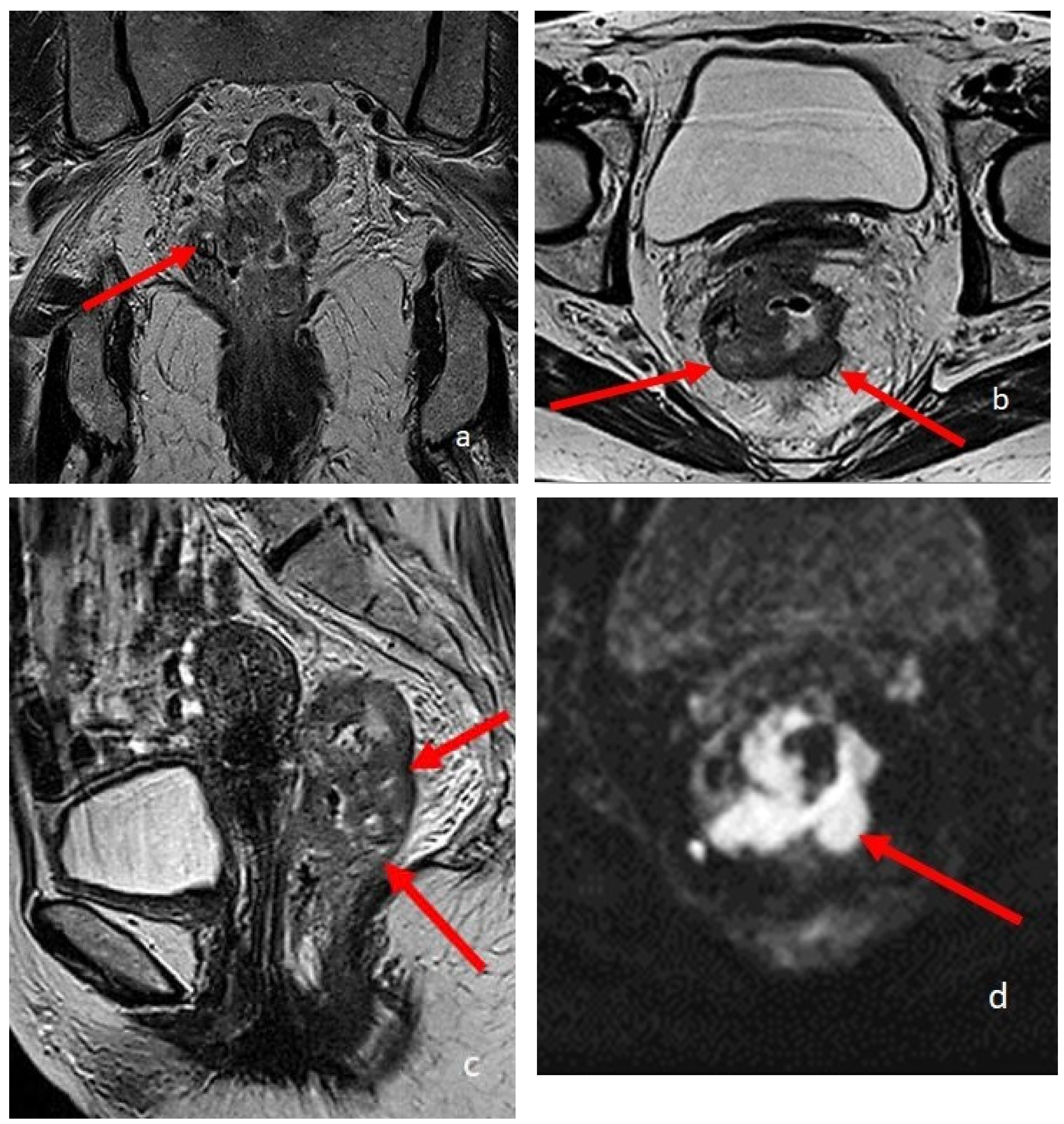 Diagnostics 13 02410 g004 Diagnostics 13 02410 g004