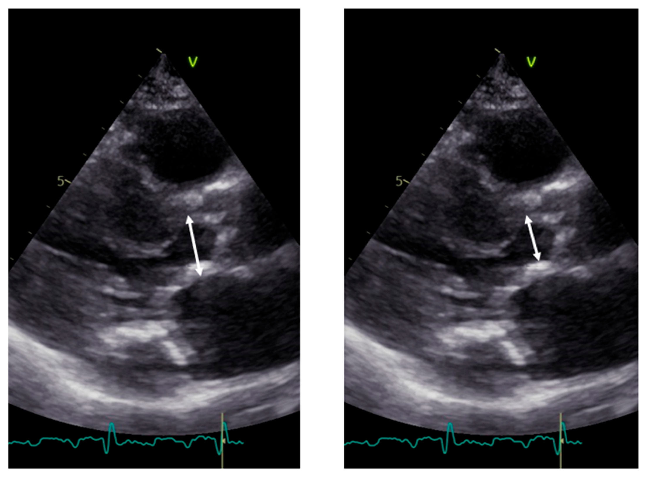 Diagnostics 13 02414 g004 Diagnostics 13 02414 g004