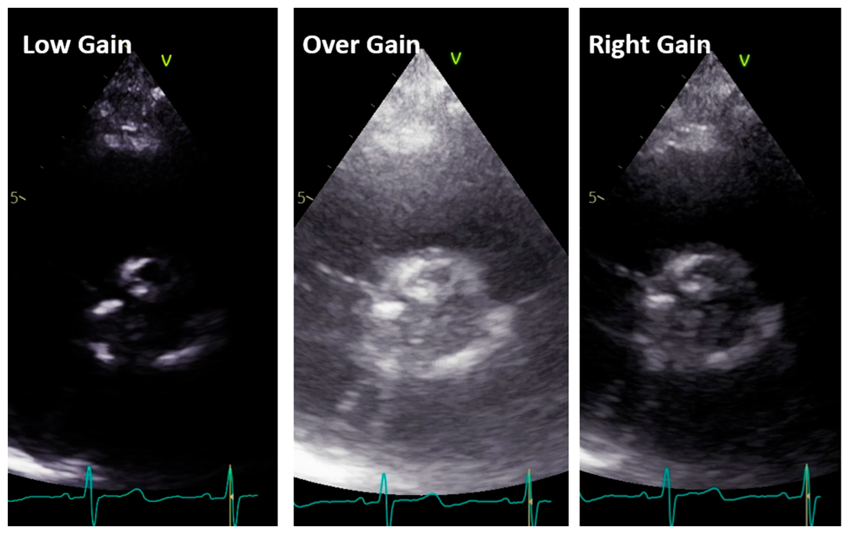 Diagnostics 13 02414 g006 Diagnostics 13 02414 g006