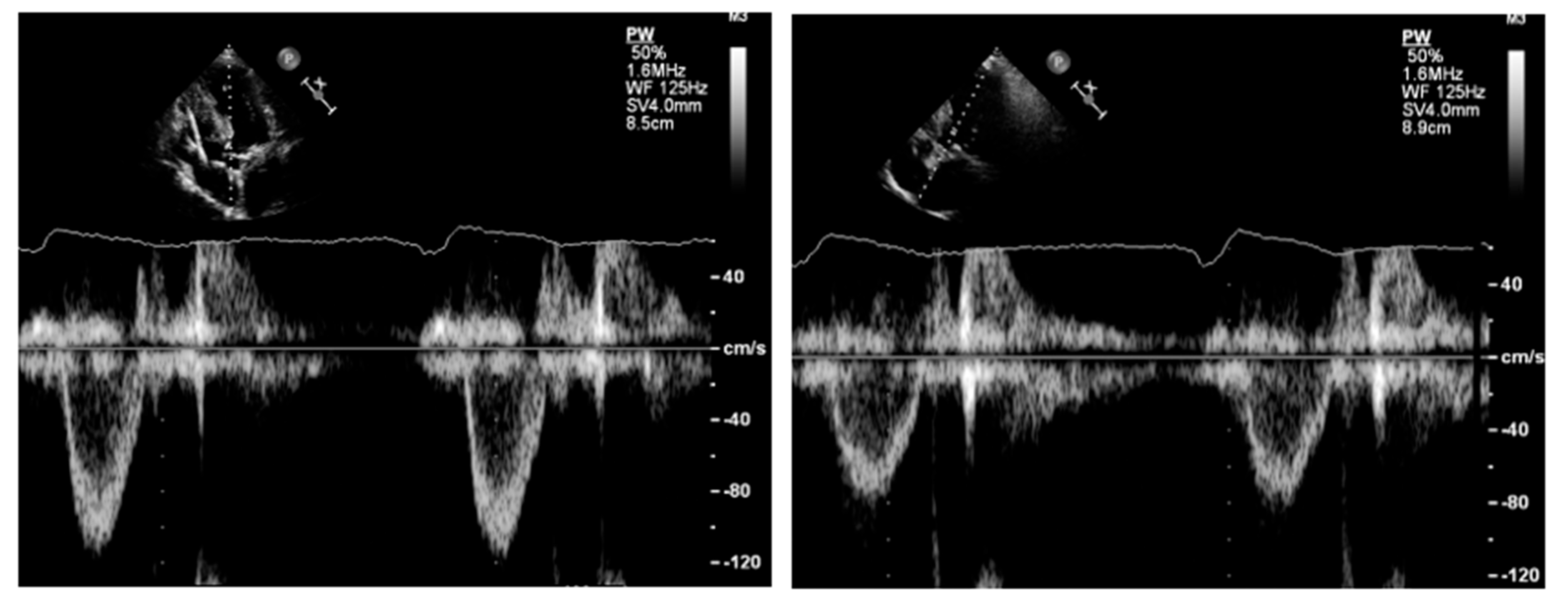 Diagnostics 13 02414 g008 Diagnostics 13 02414 g008