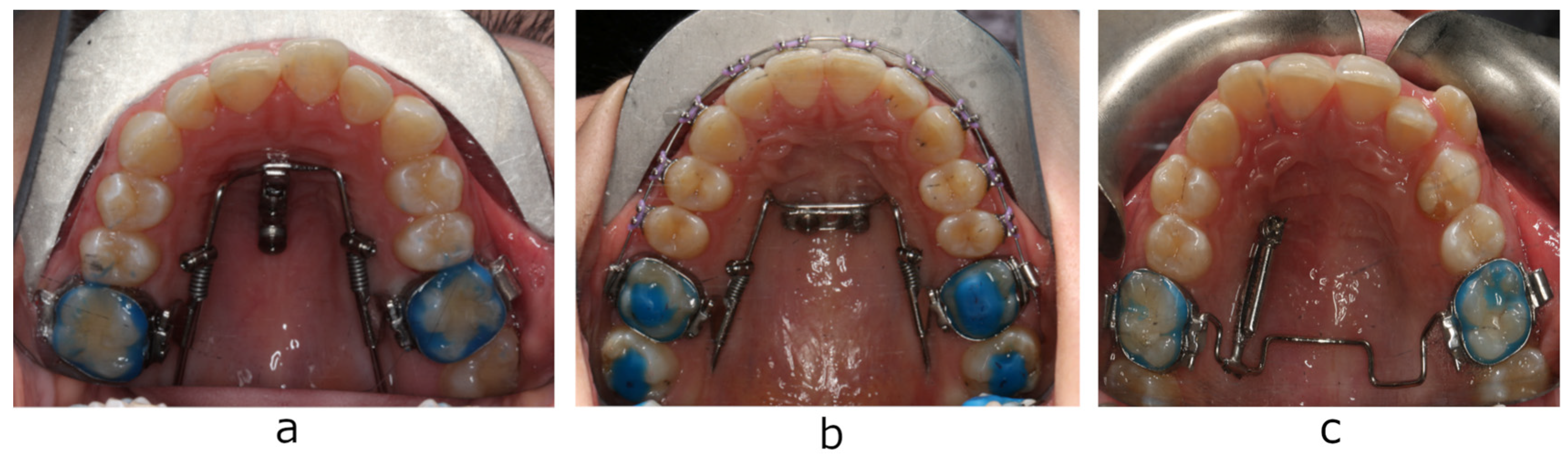 Diagnostics 13 02421 g001