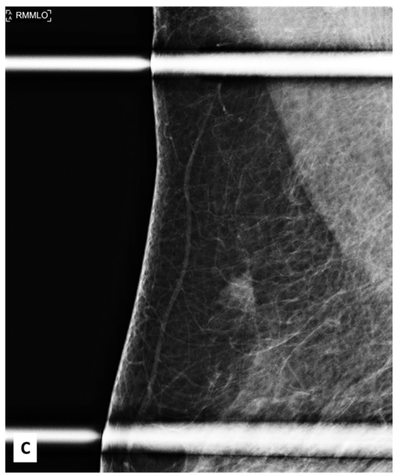 Diagnostics 13 02428 g001b