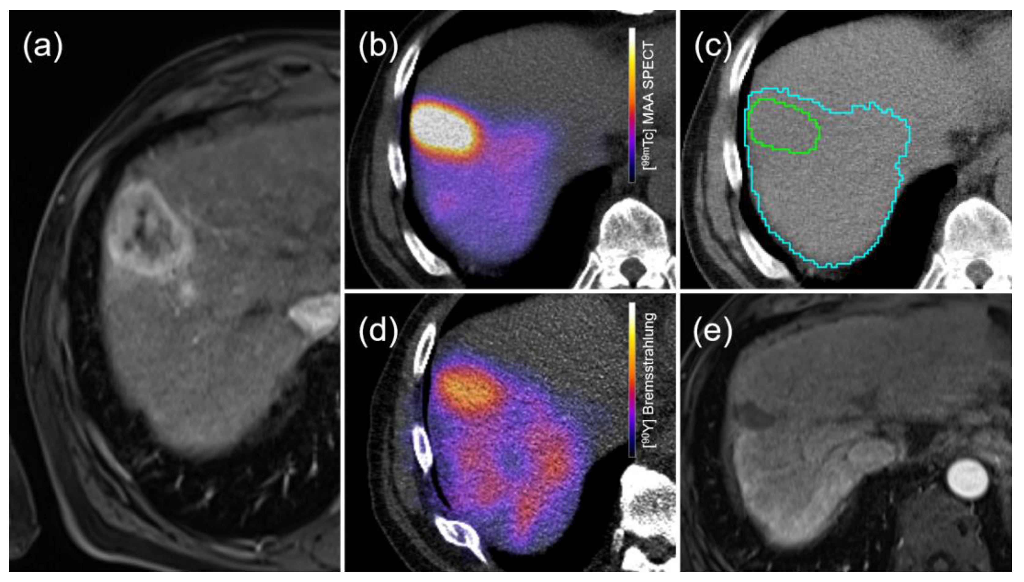 Diagnostics 13 02432 g002 Diagnostics 13 02432 g002