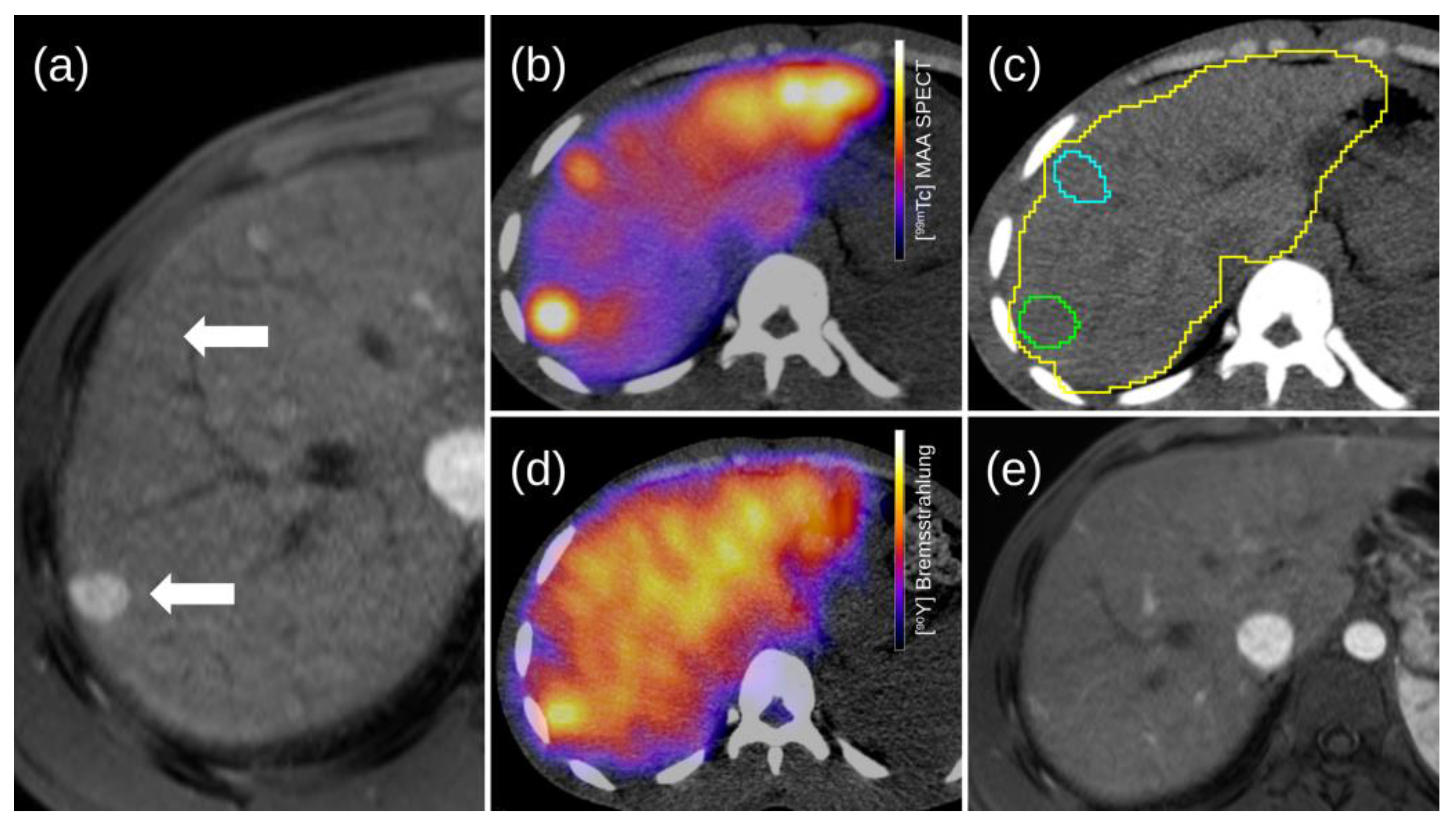 Diagnostics 13 02432 g003 Diagnostics 13 02432 g003