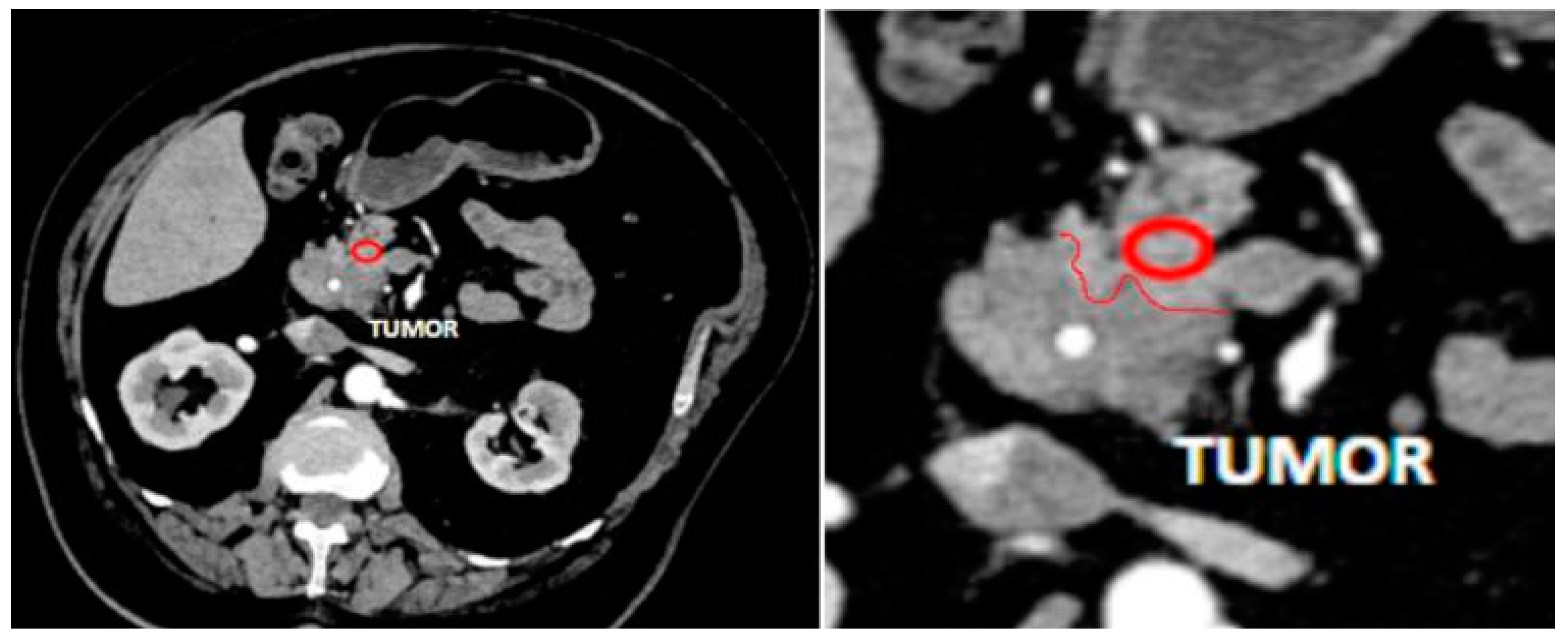 Diagnostics 13 02435 g001 Diagnostics 13 02435 g001