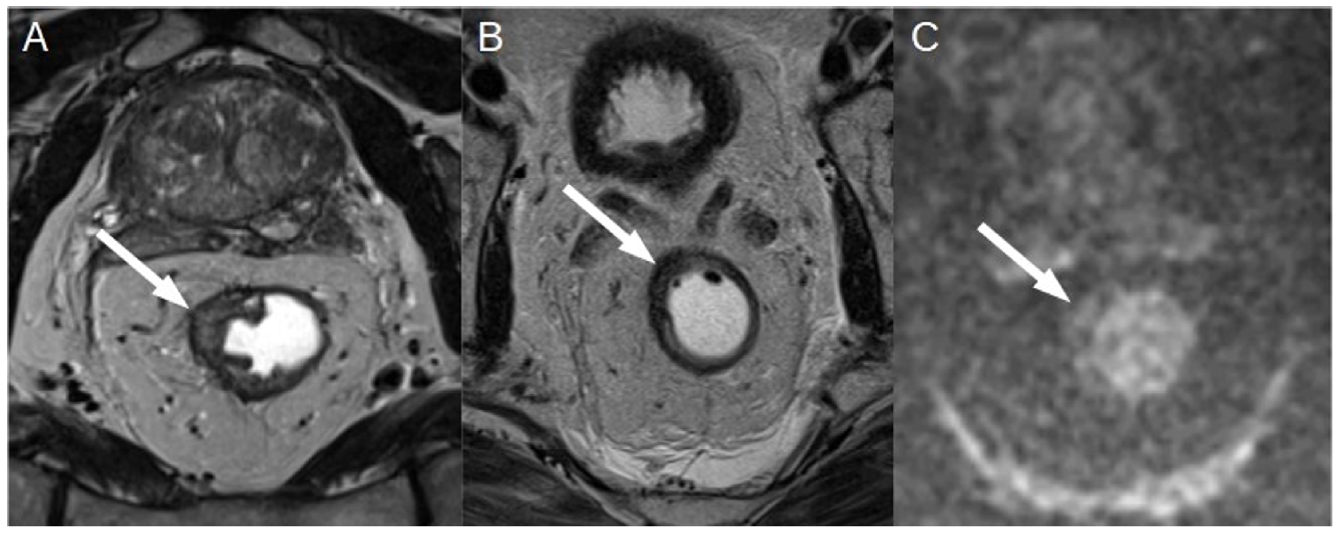 Diagnostics 13 02439 g007 Diagnostics 13 02439 g007