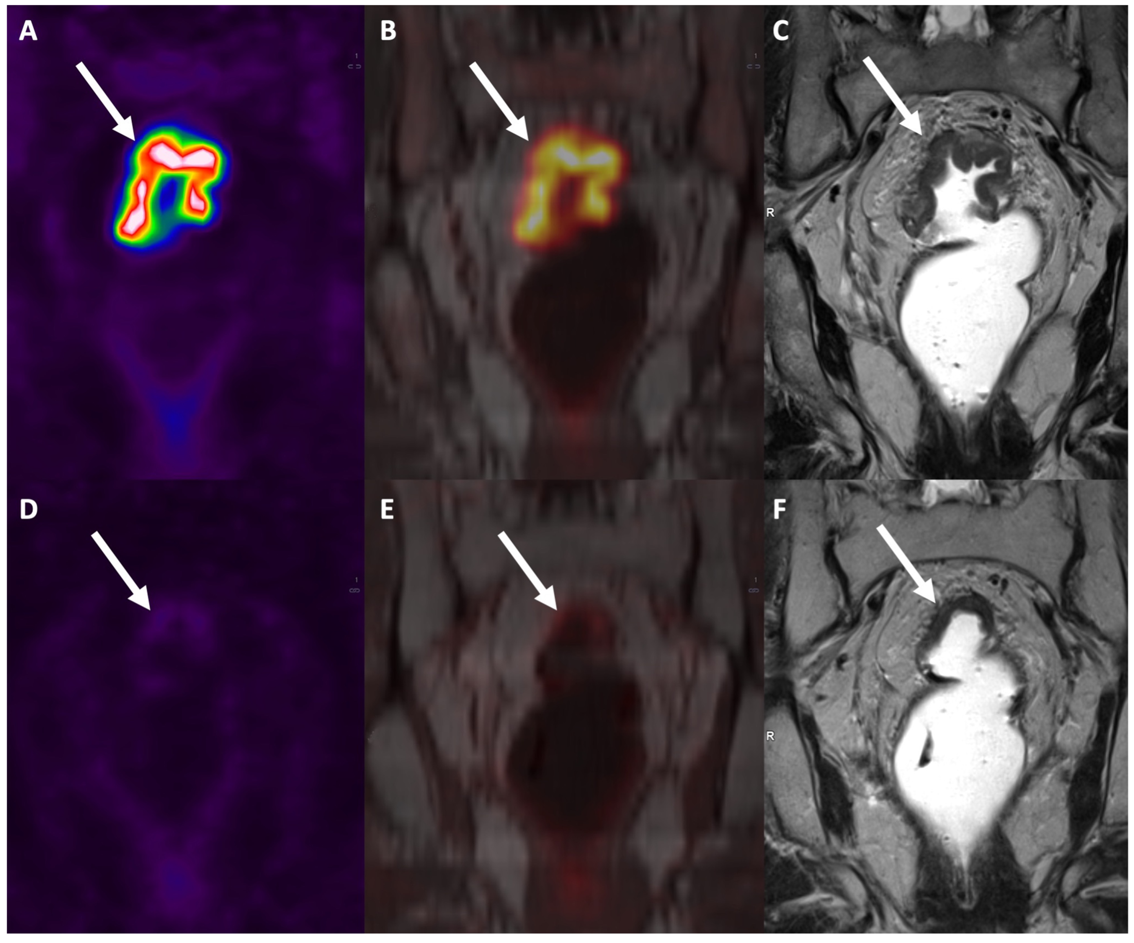 Diagnostics 13 02439 g008 Diagnostics 13 02439 g008
