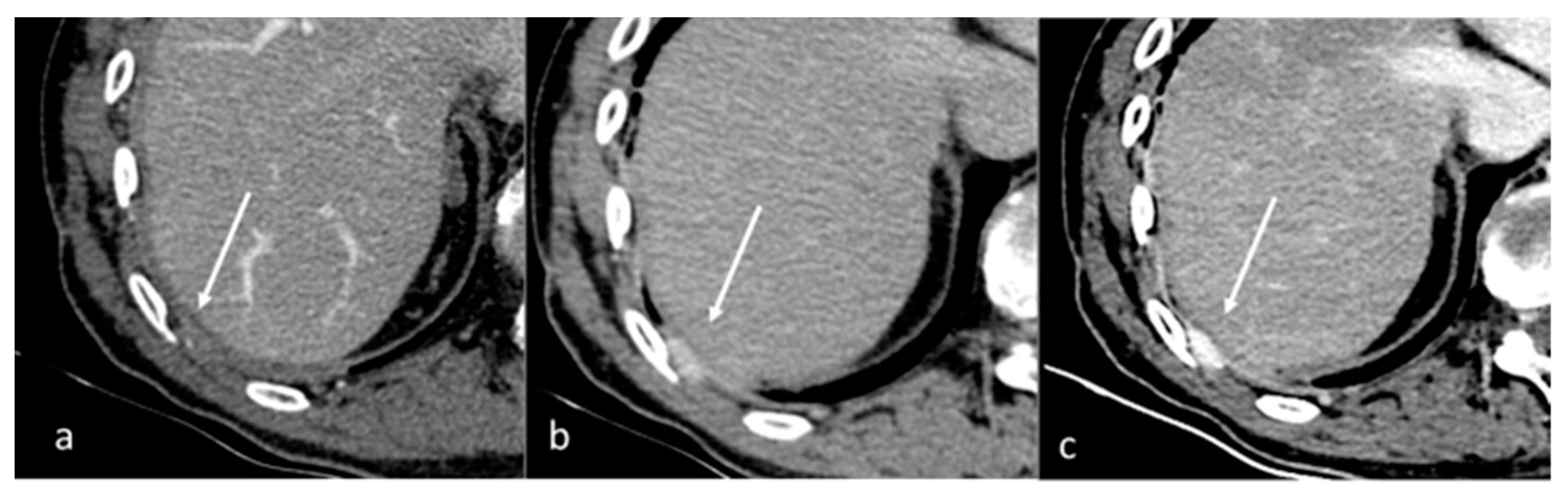 Diagnostics 13 02440 g001 Diagnostics 13 02440 g001