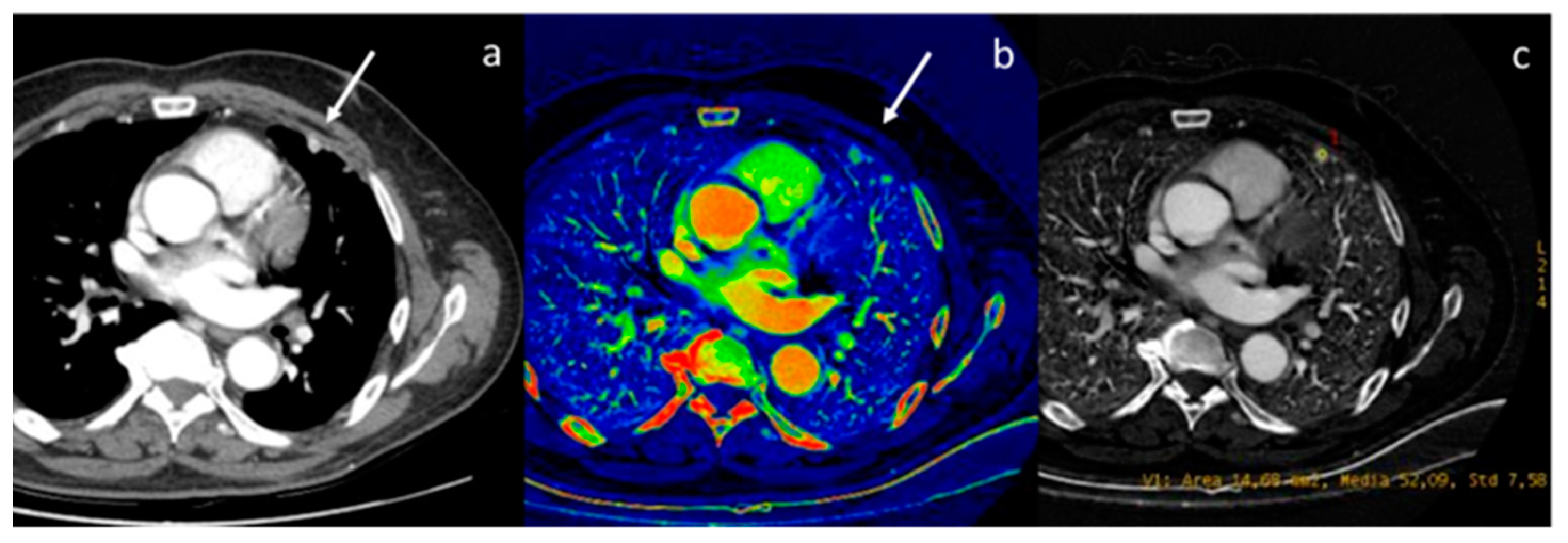 Diagnostics 13 02440 g003 Diagnostics 13 02440 g003