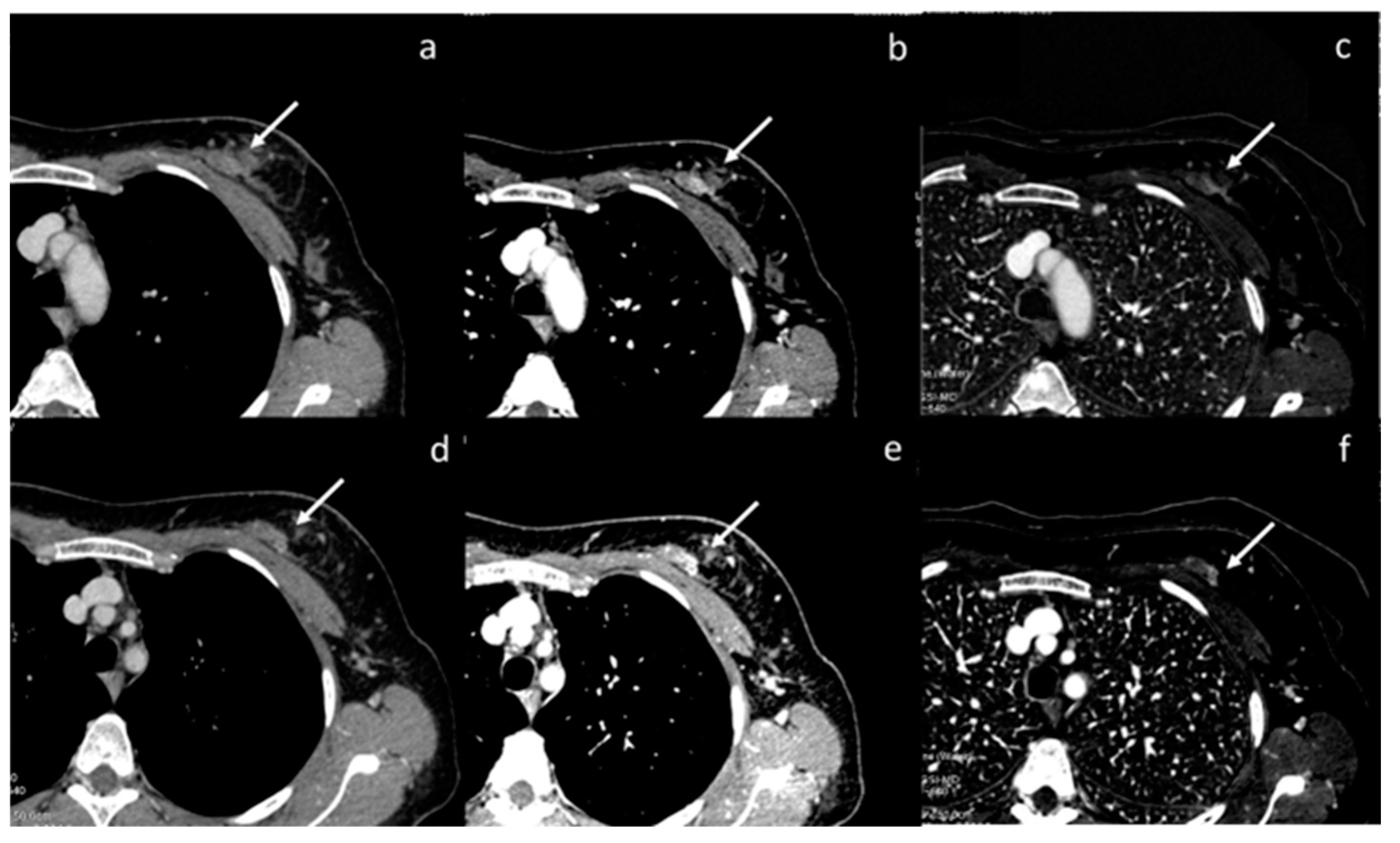 Diagnostics 13 02440 g004 Diagnostics 13 02440 g004