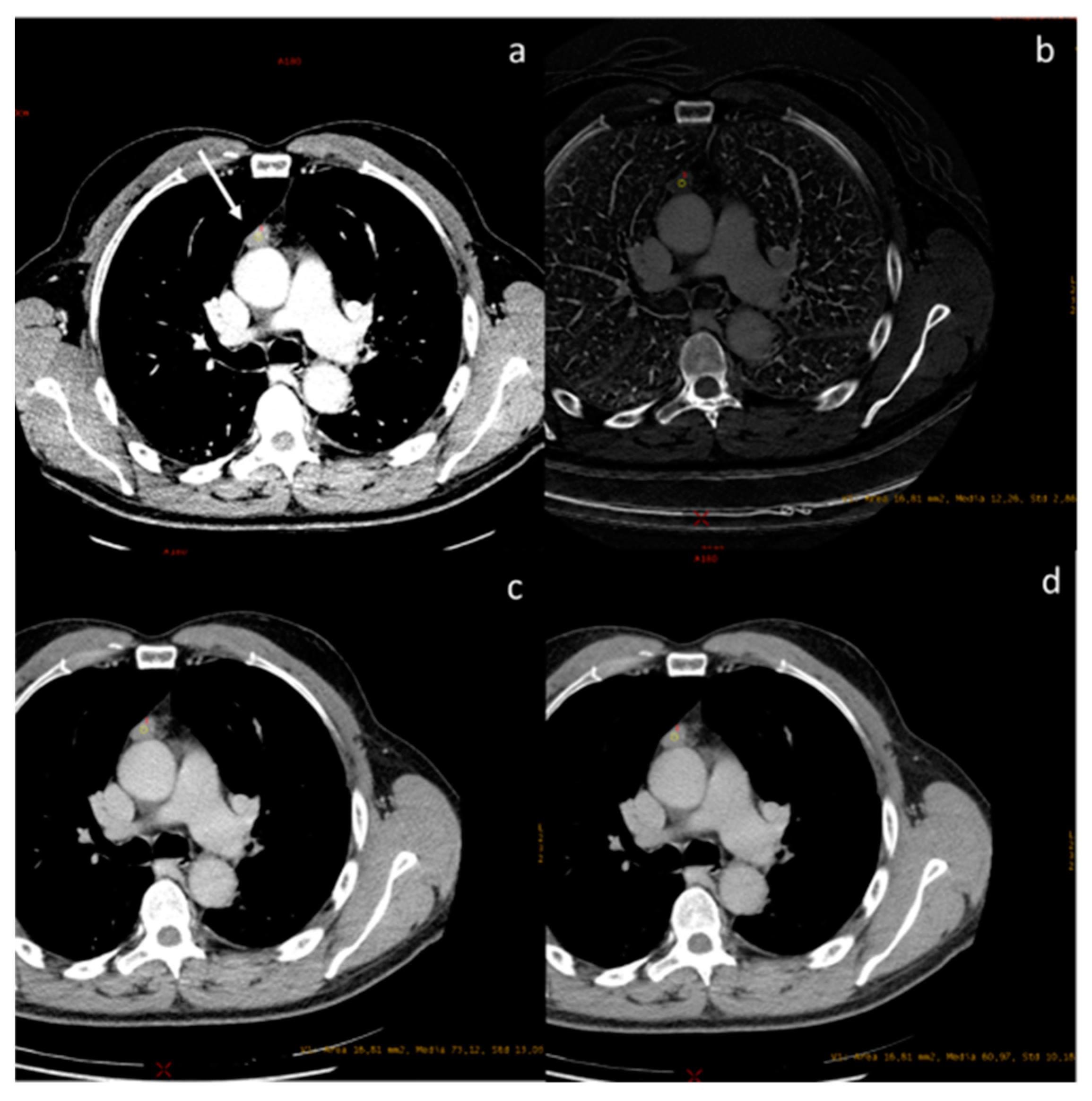 Diagnostics 13 02440 g007 Diagnostics 13 02440 g007