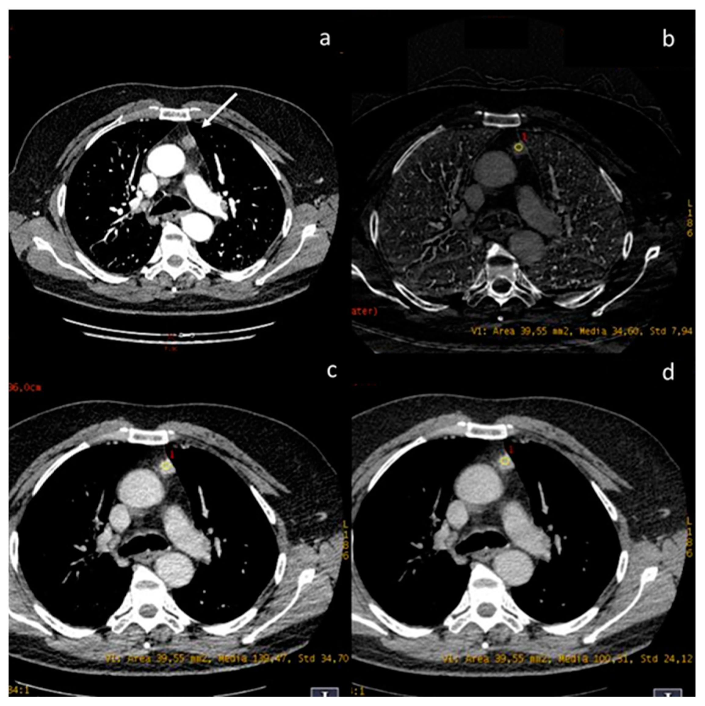 Diagnostics 13 02440 g008 Diagnostics 13 02440 g008