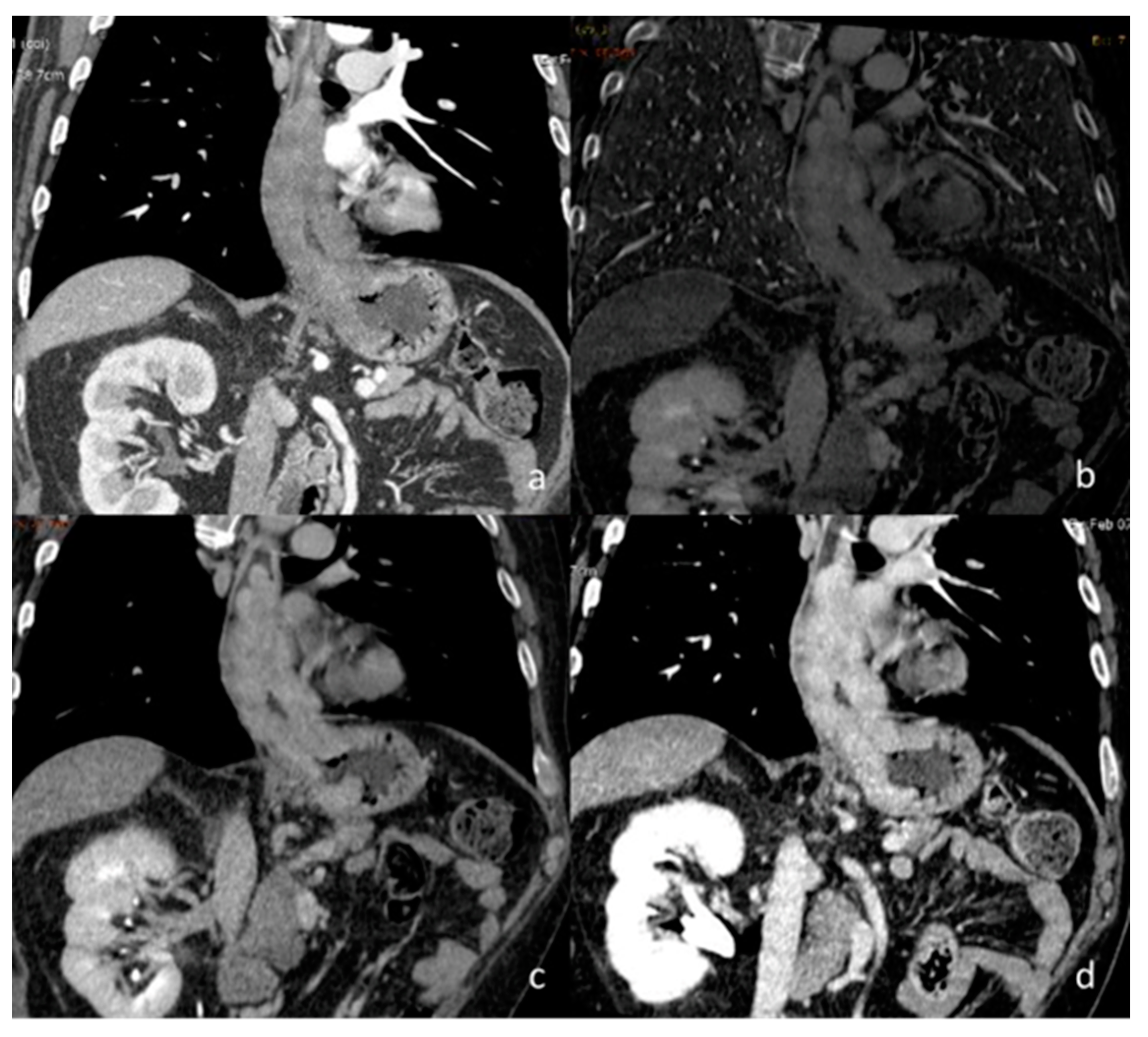 Diagnostics 13 02440 g010 Diagnostics 13 02440 g010