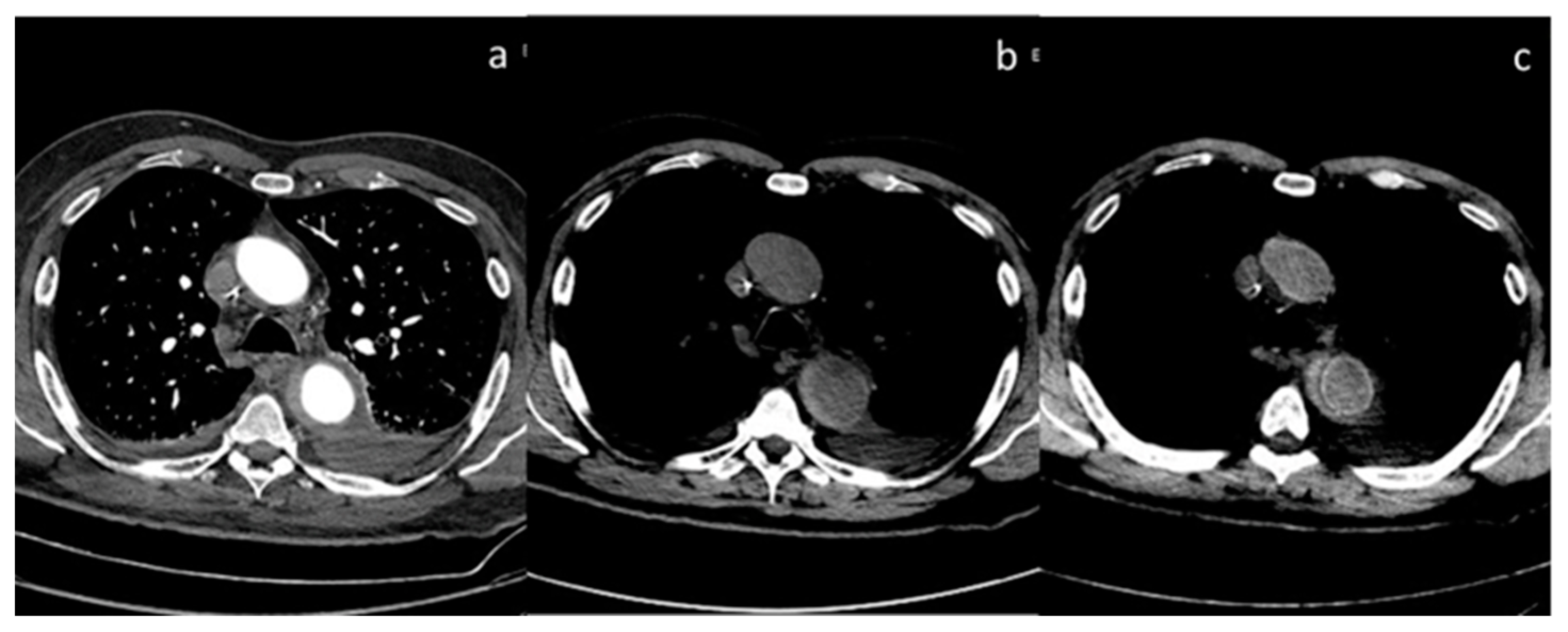 Diagnostics 13 02440 g011 Diagnostics 13 02440 g011