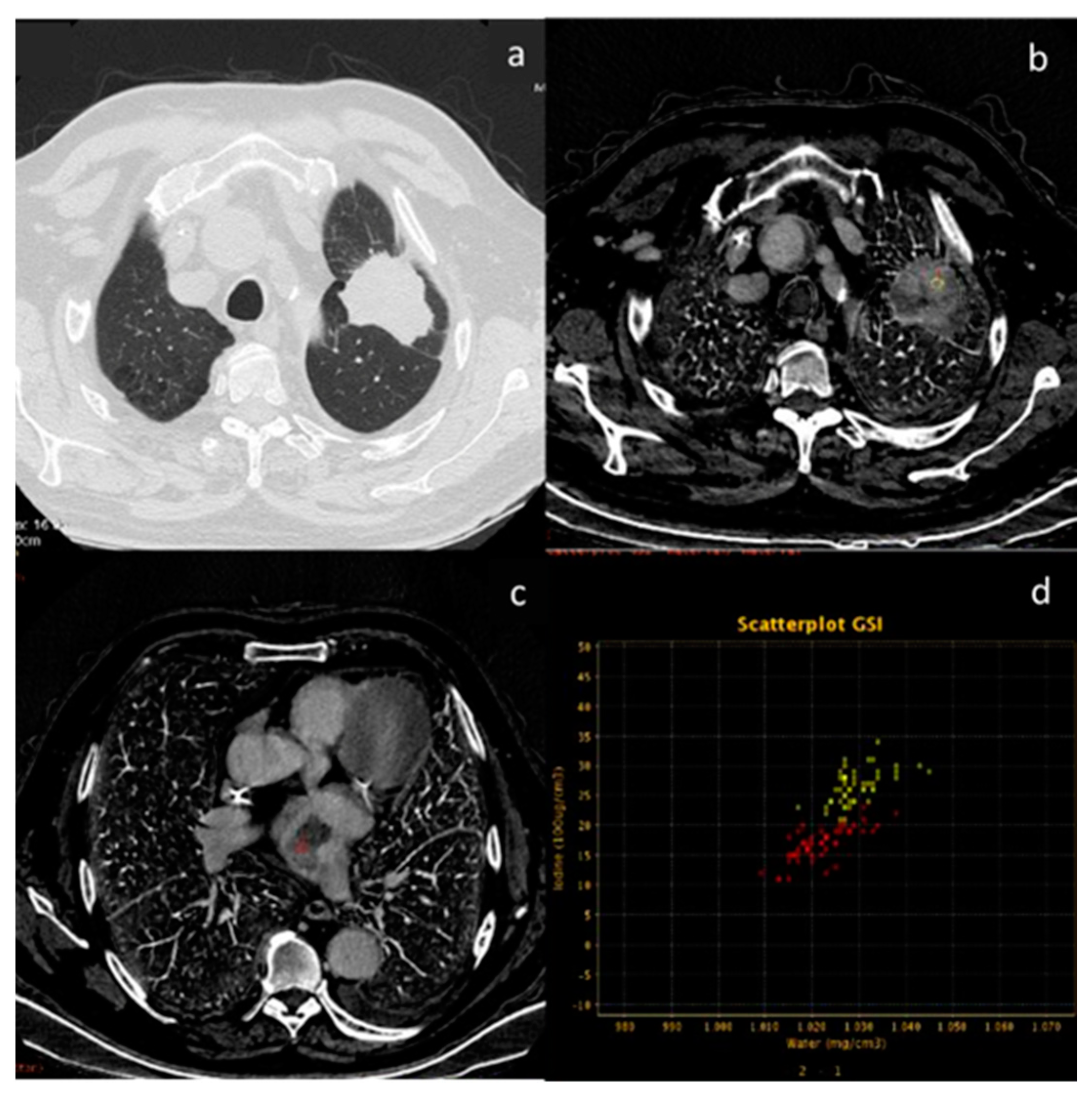 Diagnostics 13 02440 g013 Diagnostics 13 02440 g013