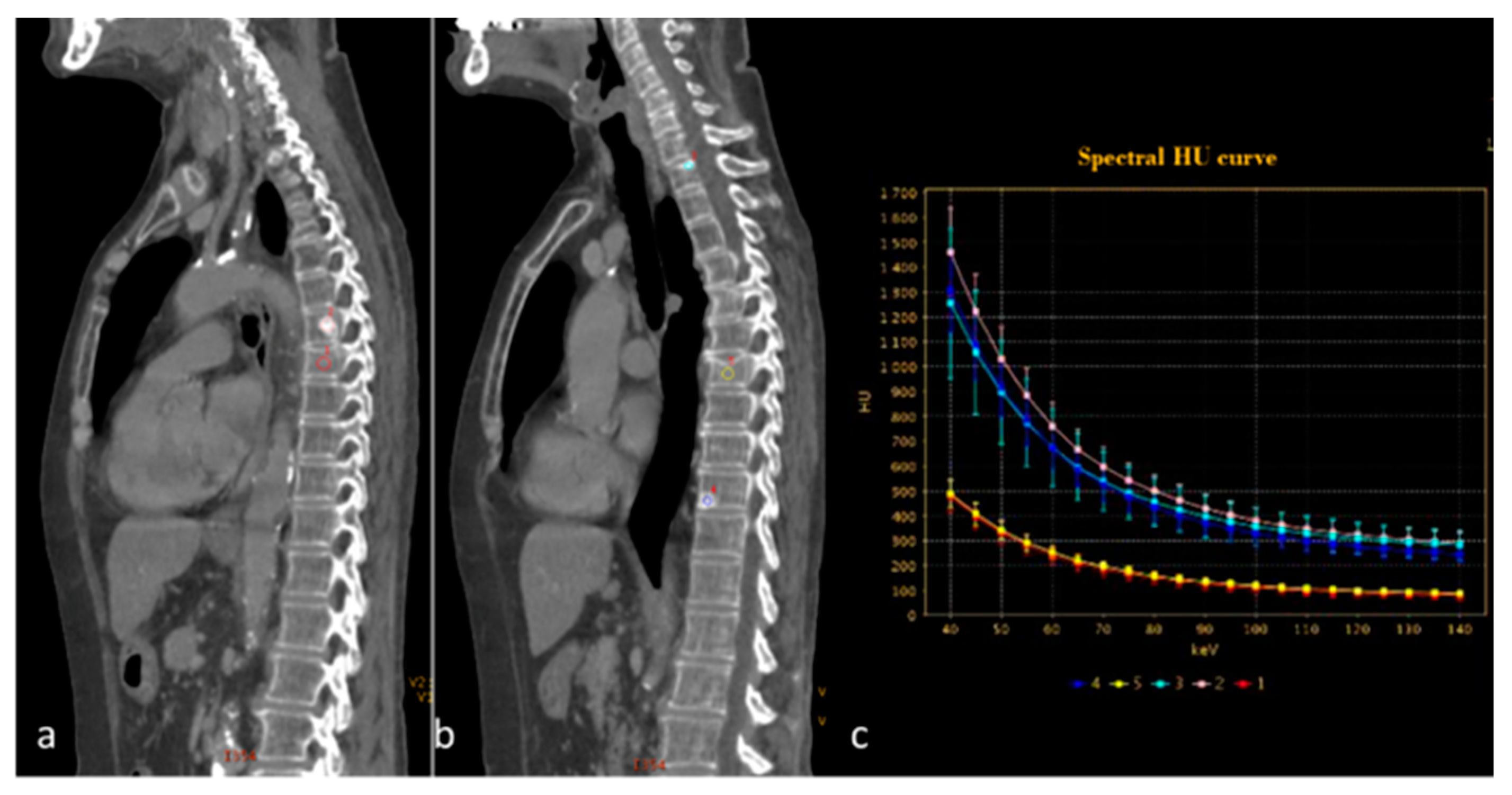 Diagnostics 13 02440 g014 Diagnostics 13 02440 g014