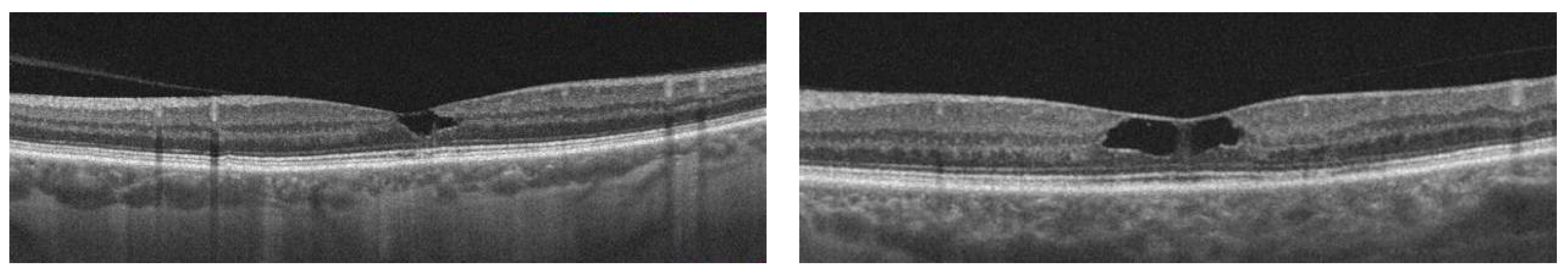 Diagnostics 13 02444 g002 Diagnostics 13 02444 g002