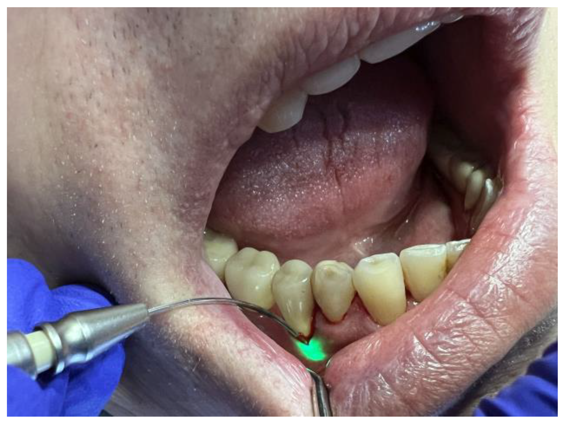 Diagnostics 13 02450 g004