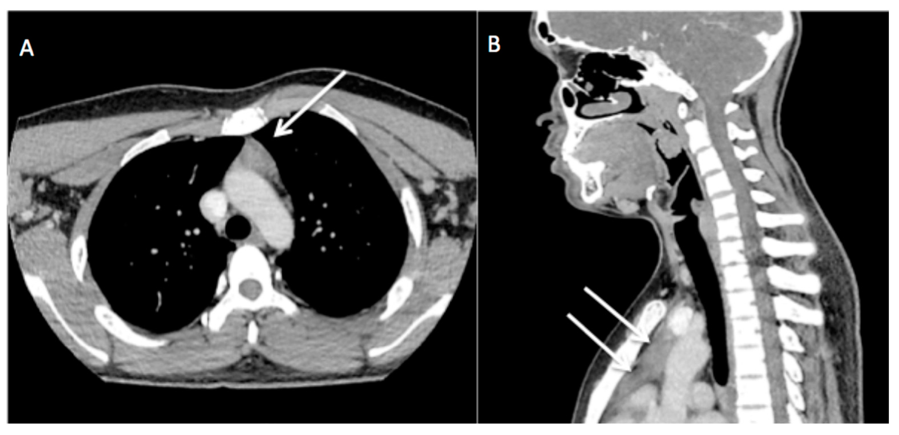 Diagnostics 13 02457 g002