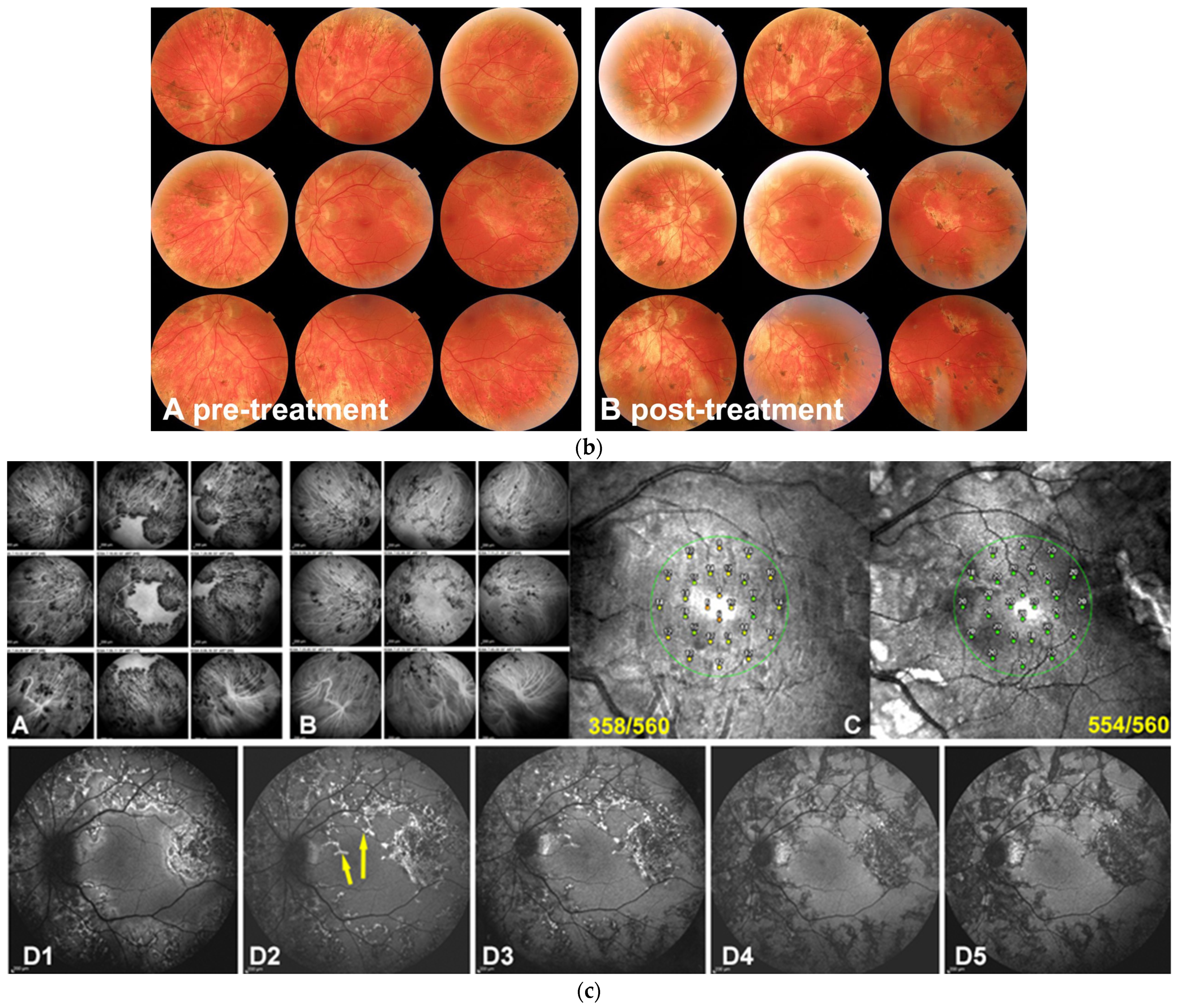Diagnostics 13 02466 g005b Diagnostics 13 02466 g005b