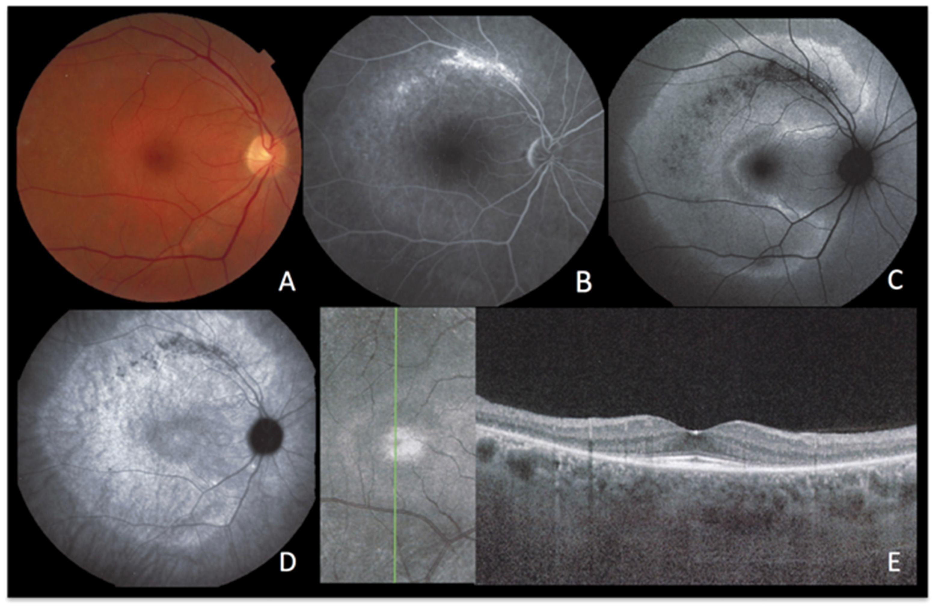 Diagnostics 13 02466 g007 Diagnostics 13 02466 g007