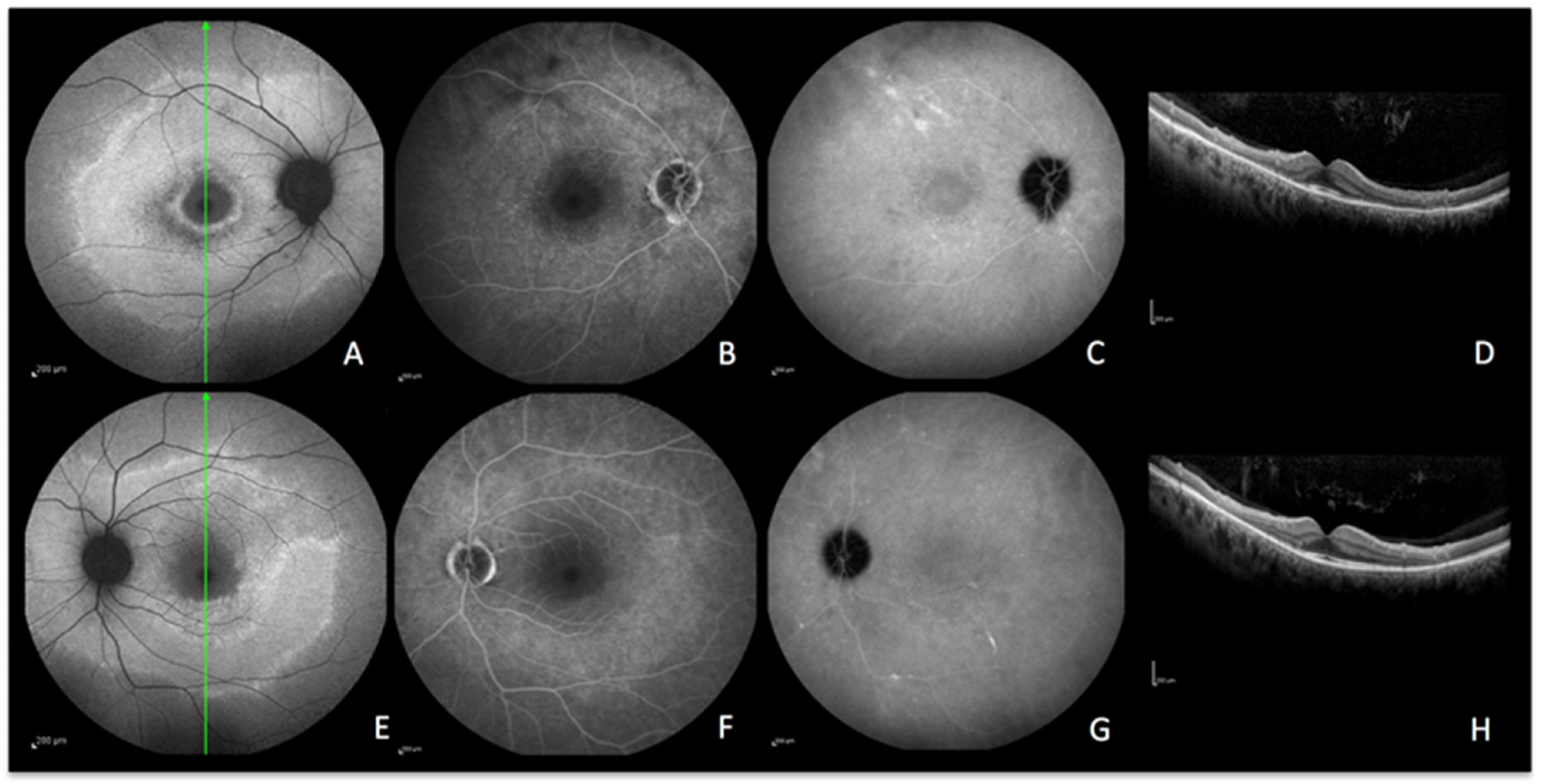Diagnostics 13 02466 g008 Diagnostics 13 02466 g008