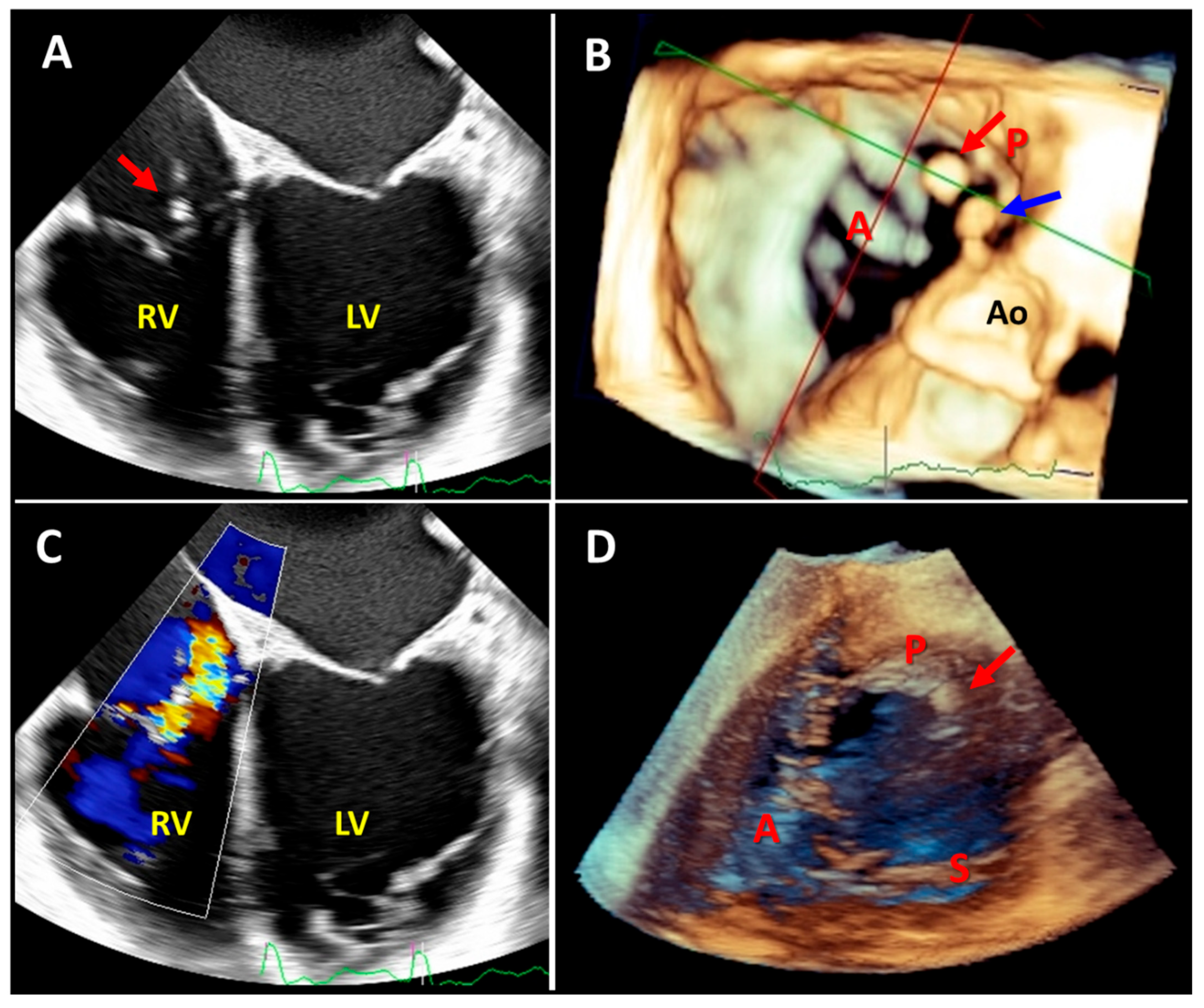 Diagnostics 13 02470 g006 Diagnostics 13 02470 g006