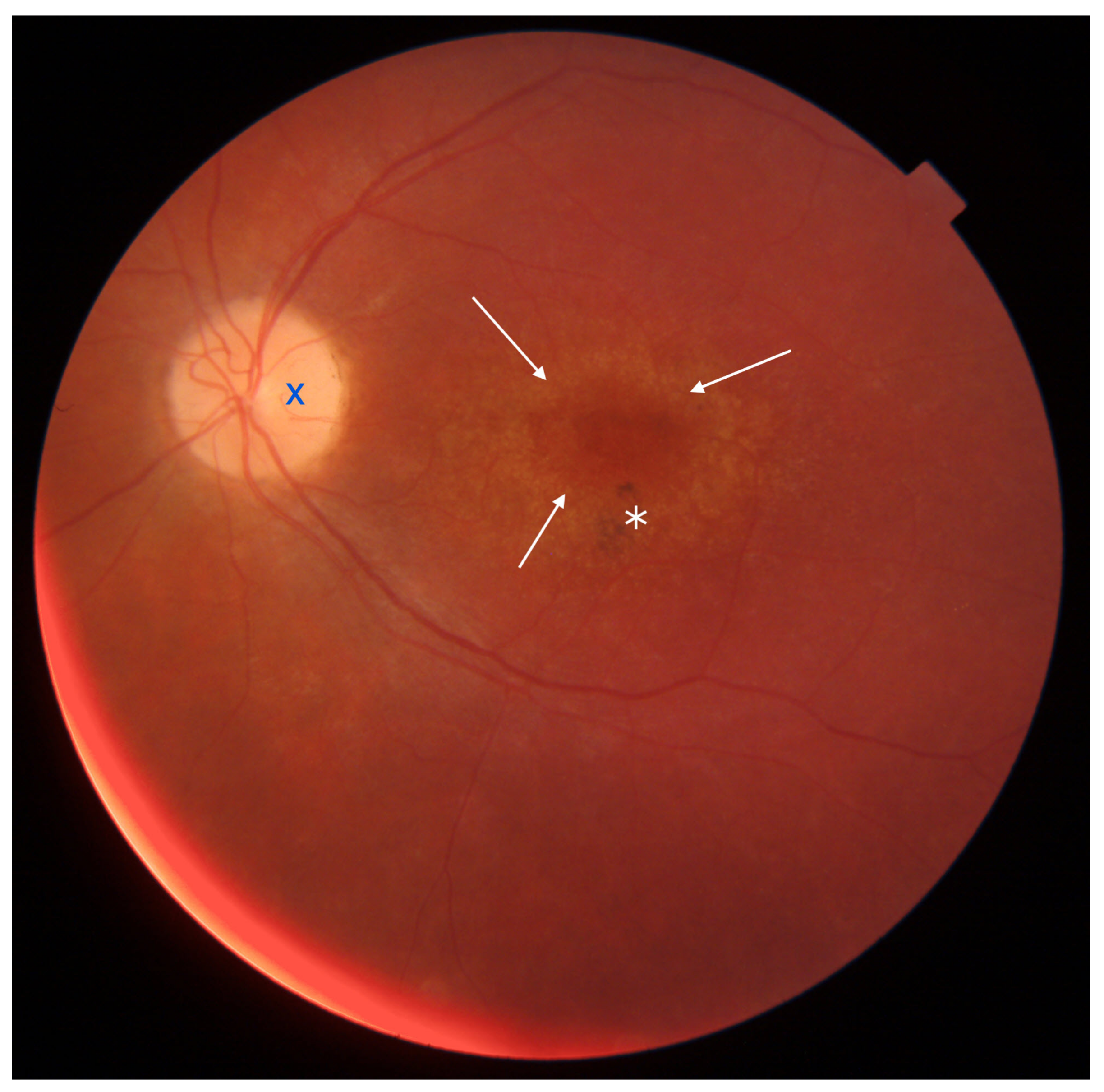 Diagnostics 13 02472 g005