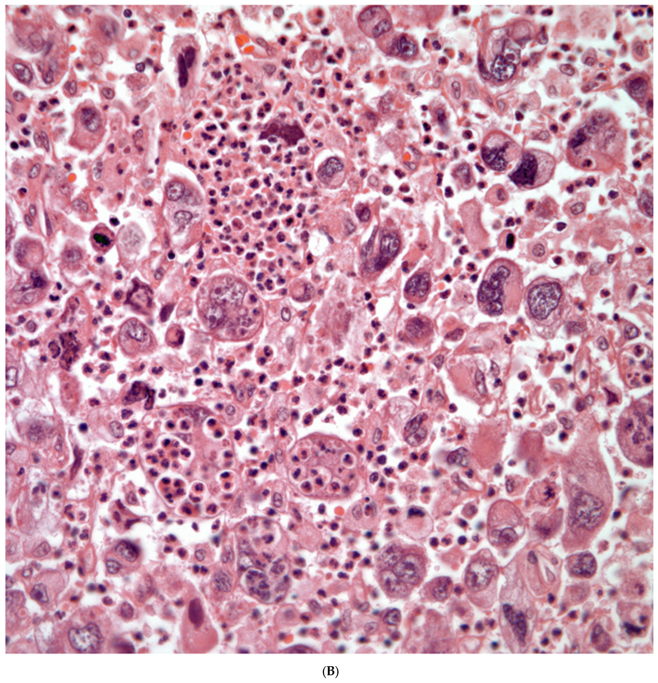 Diagnostics 13 02477 g006b