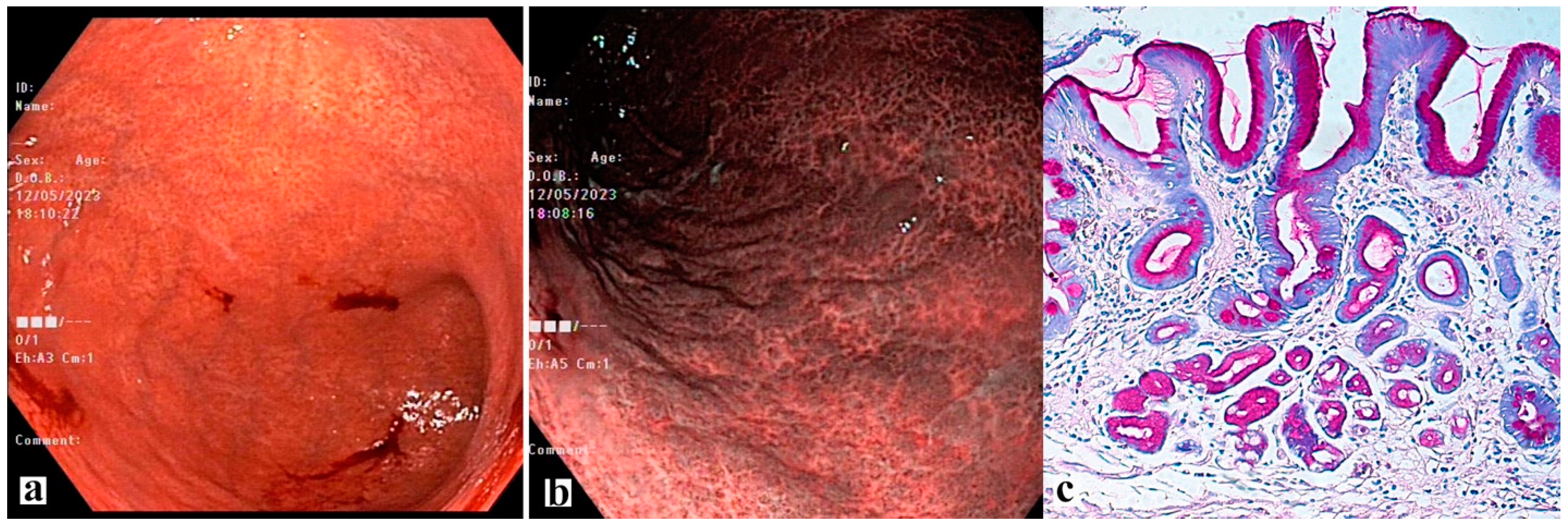Diagnostics 13 02478 g005 Diagnostics 13 02478 g005