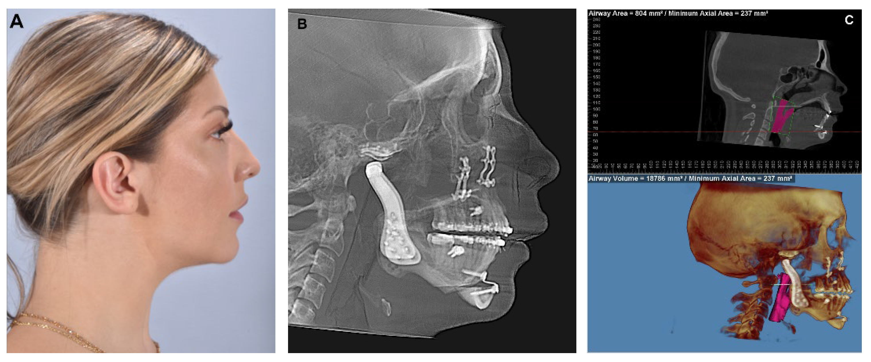 Diagnostics 13 02486 g015