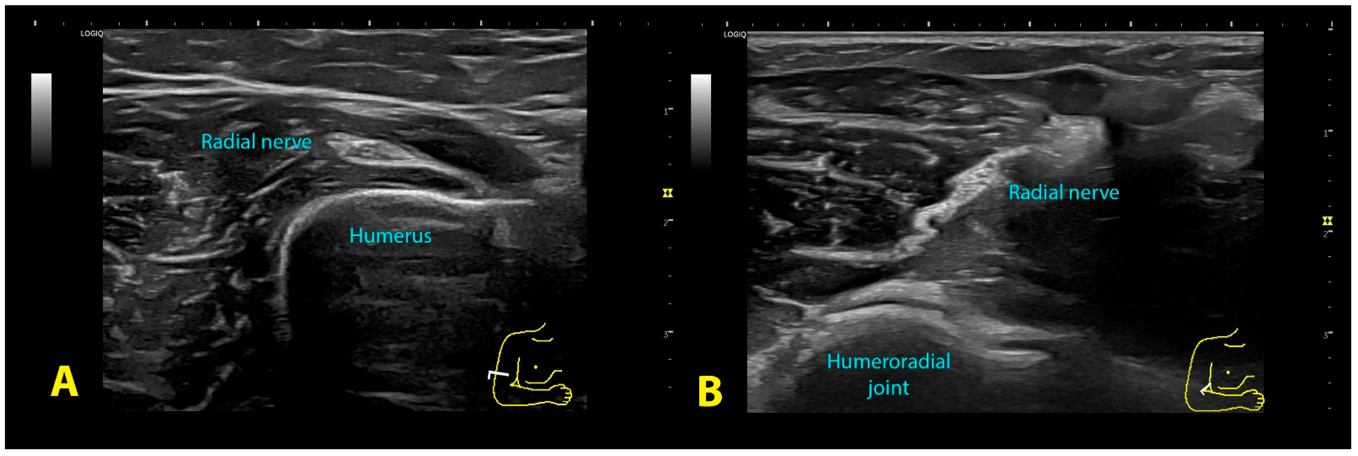 Diagnostics 13 02488 g003